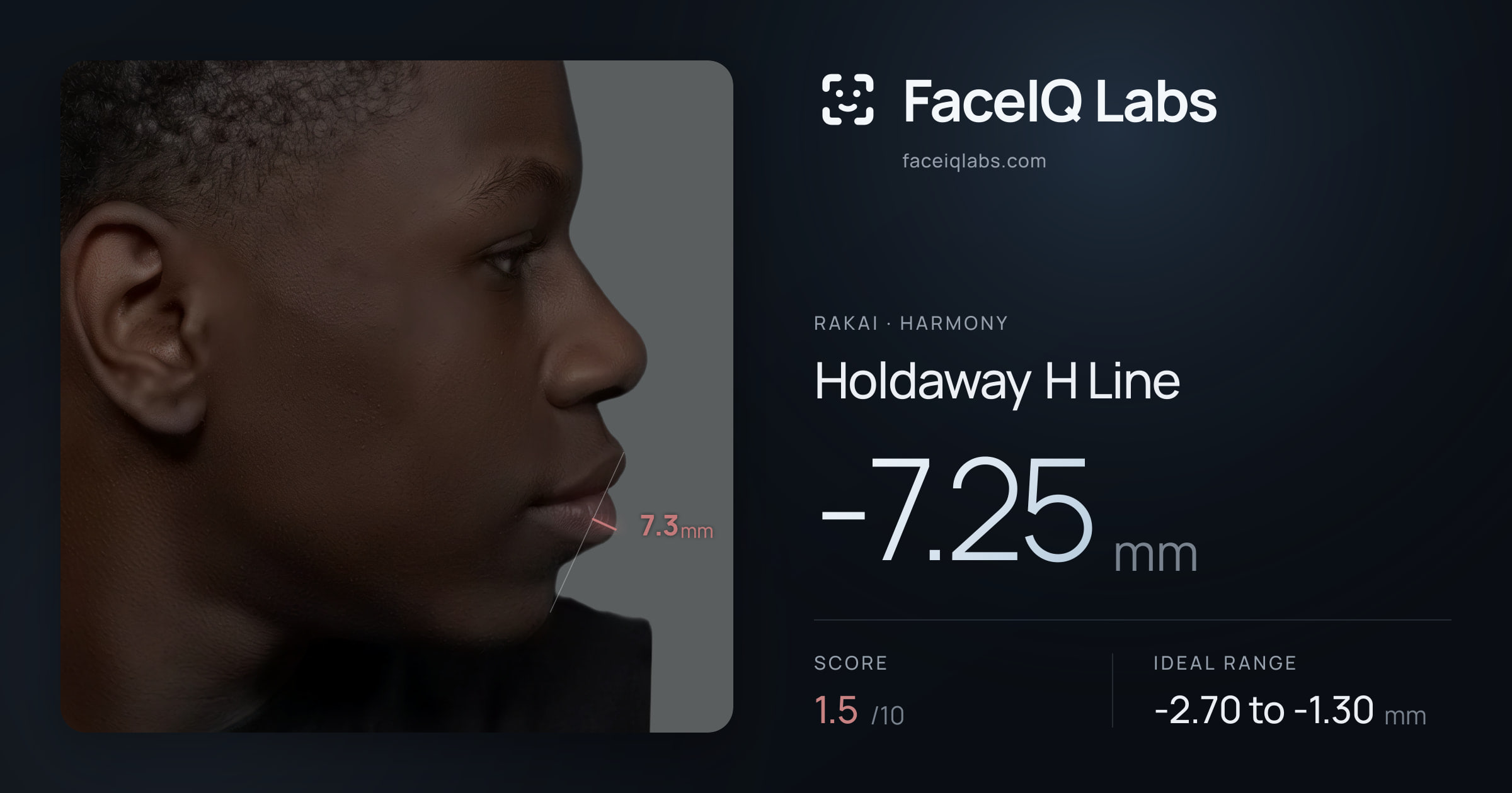 Rakai Holdaway H Line: -7.25mm, drawn on the photo