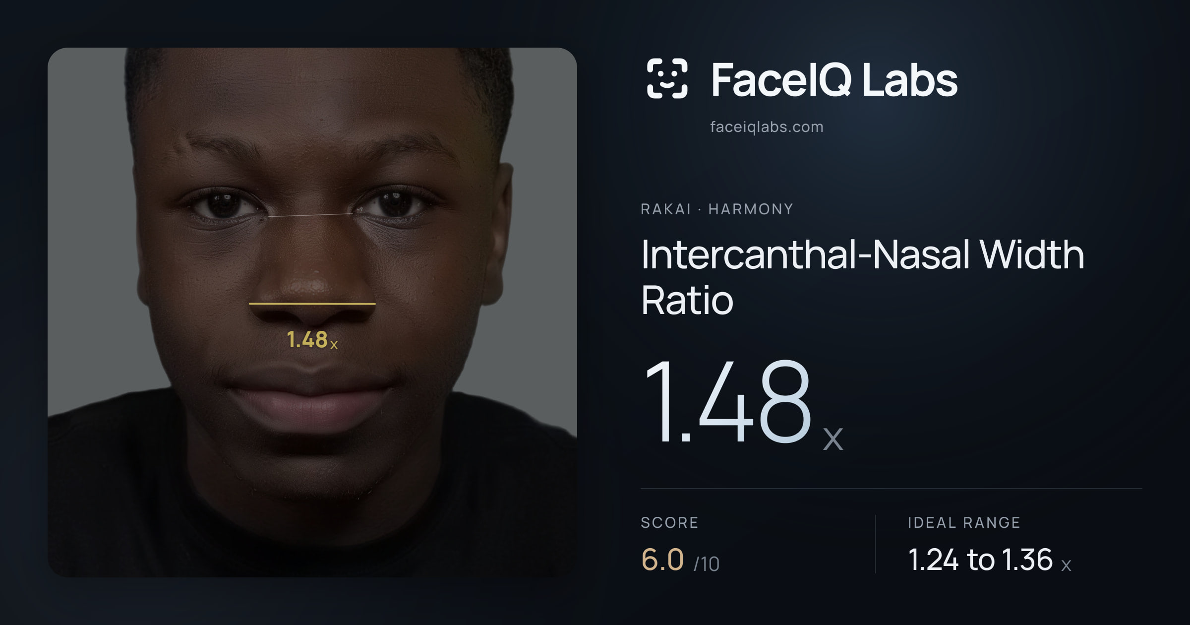 Rakai Intercanthal-Nasal Width Ratio: 1.48x, drawn on the photo