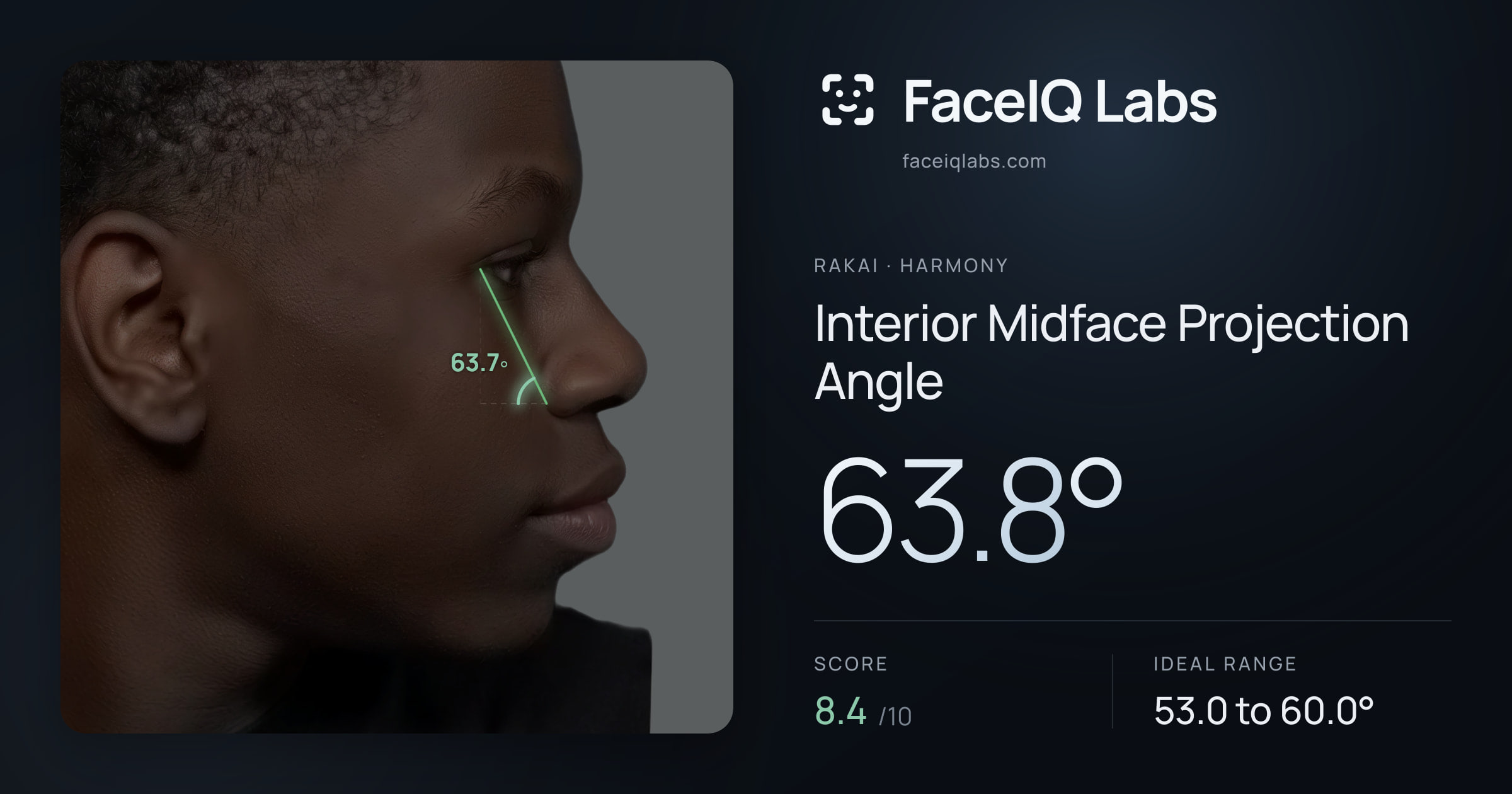 Rakai Interior Midface Projection Angle: 63.8°, drawn on the photo