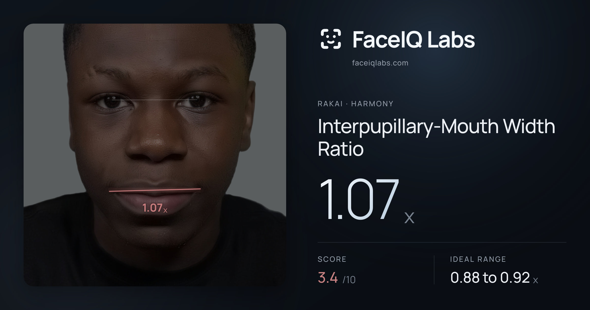 Rakai Interpupillary-Mouth Width Ratio: 1.07x, drawn on the photo