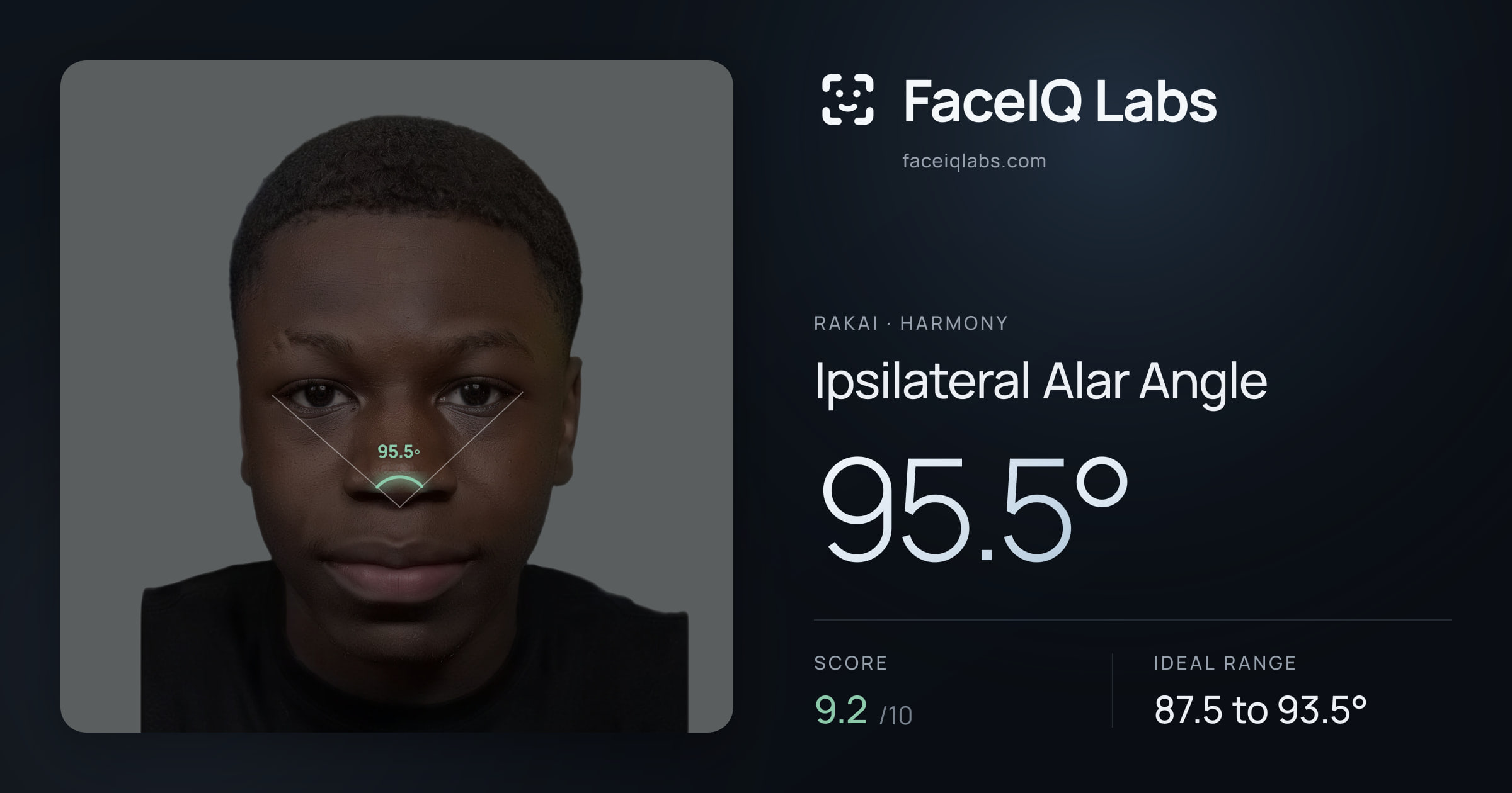 Rakai Ipsilateral Alar Angle: 95.5°, drawn on the photo