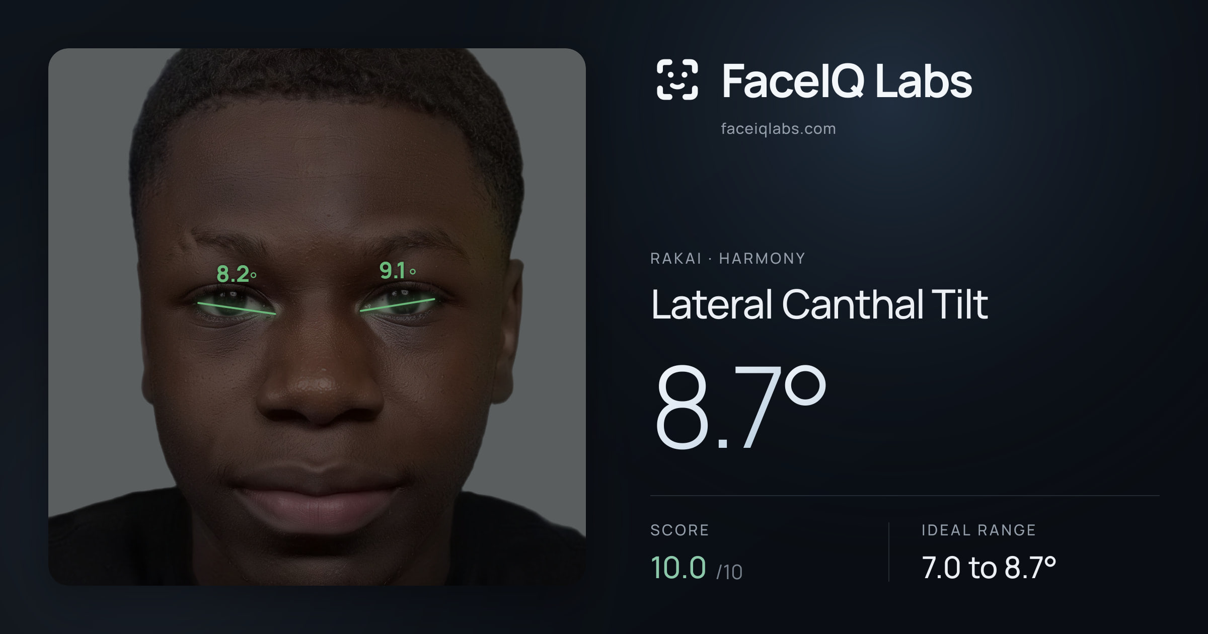 Rakai Lateral Canthal Tilt: 8.7°, drawn on the photo
