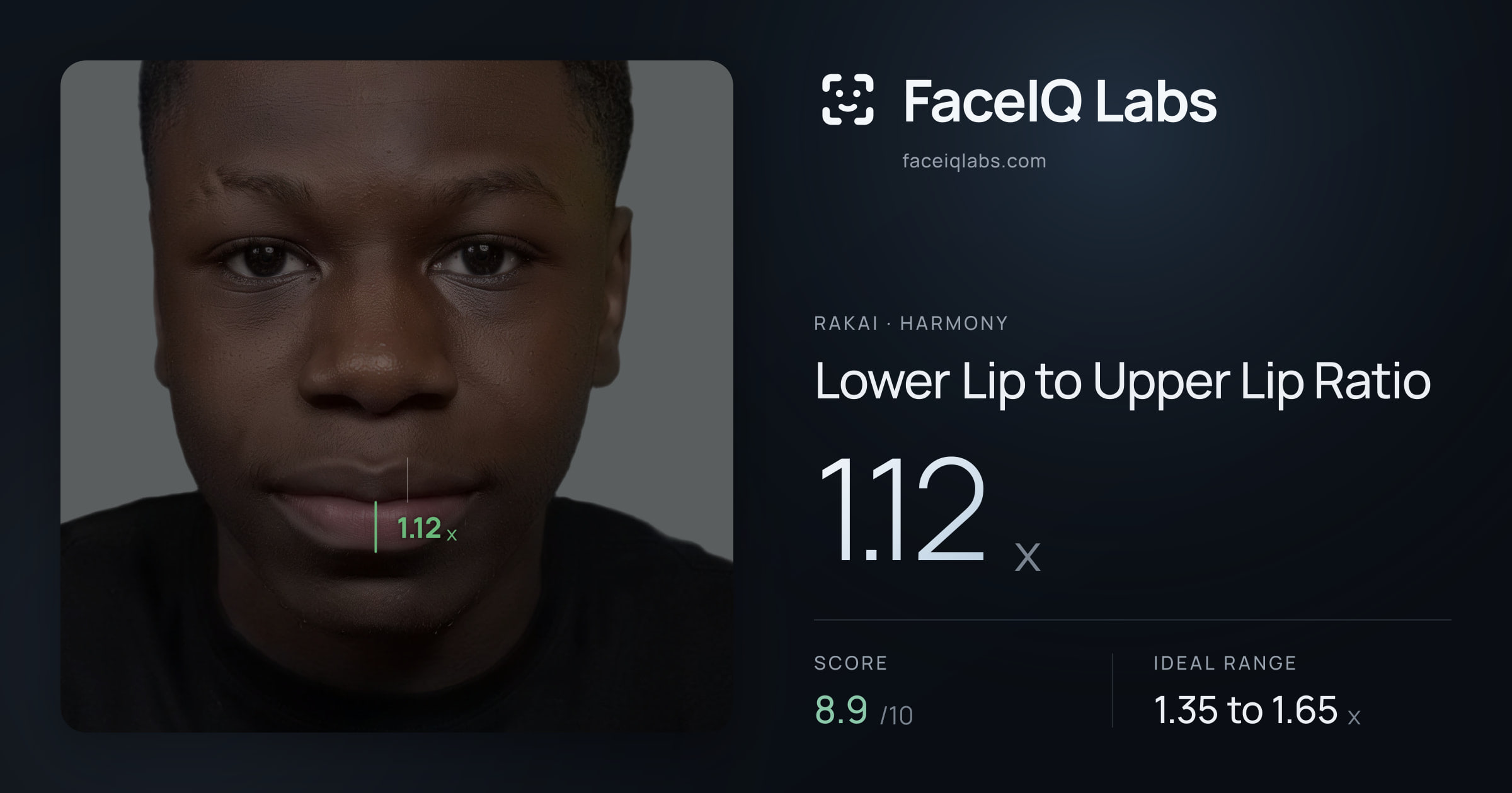 Rakai Lower Lip to Upper Lip Ratio: 1.12x, drawn on the photo