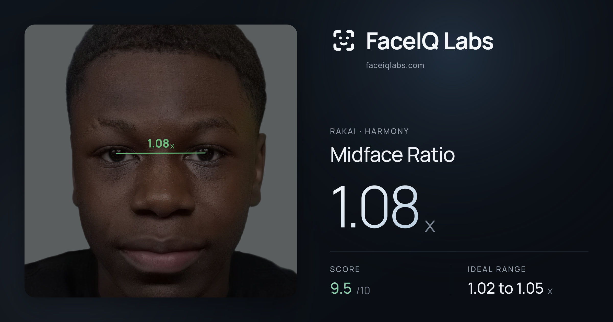 Rakai Midface Ratio: 1.08x, drawn on the photo