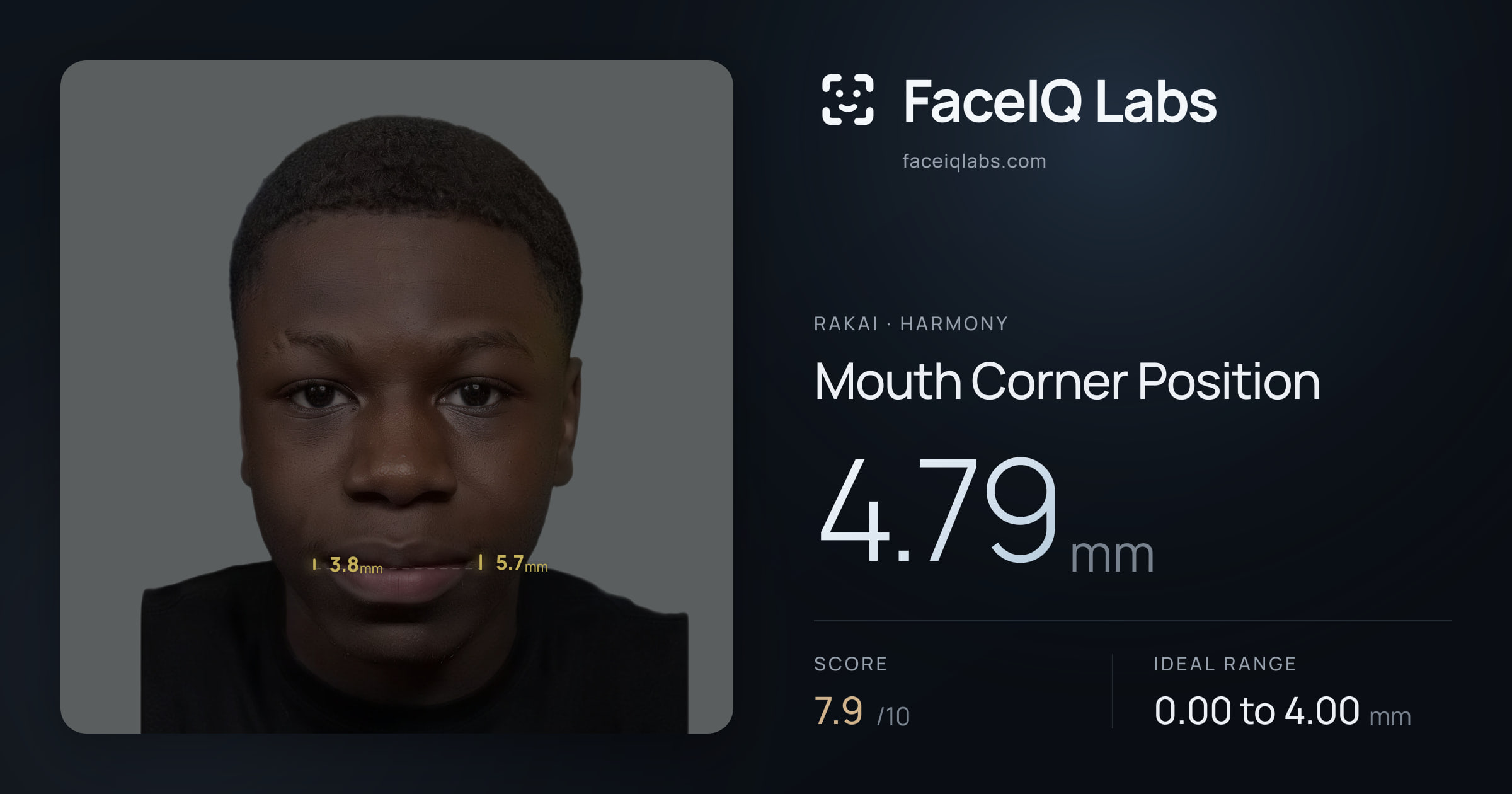 Rakai Mouth Corner Position: 4.79mm, drawn on the photo