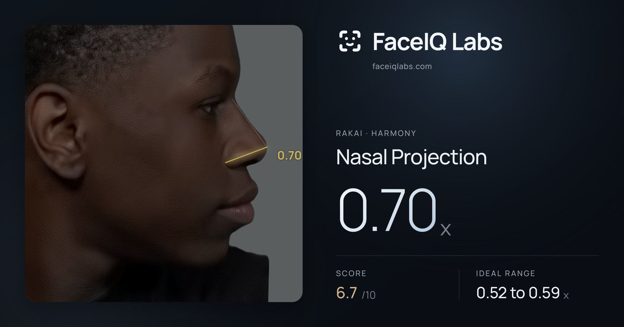 Rakai Nasal Projection: 0.70x, drawn on the photo