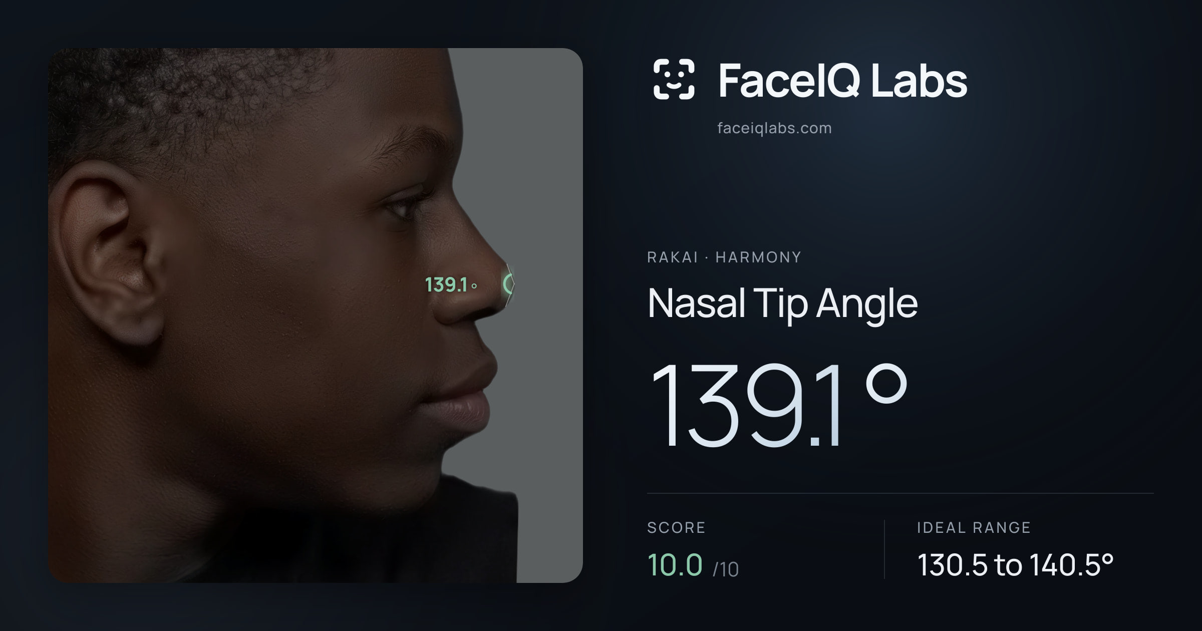 Rakai Nasal Tip Angle: 145.6°, drawn on the photo