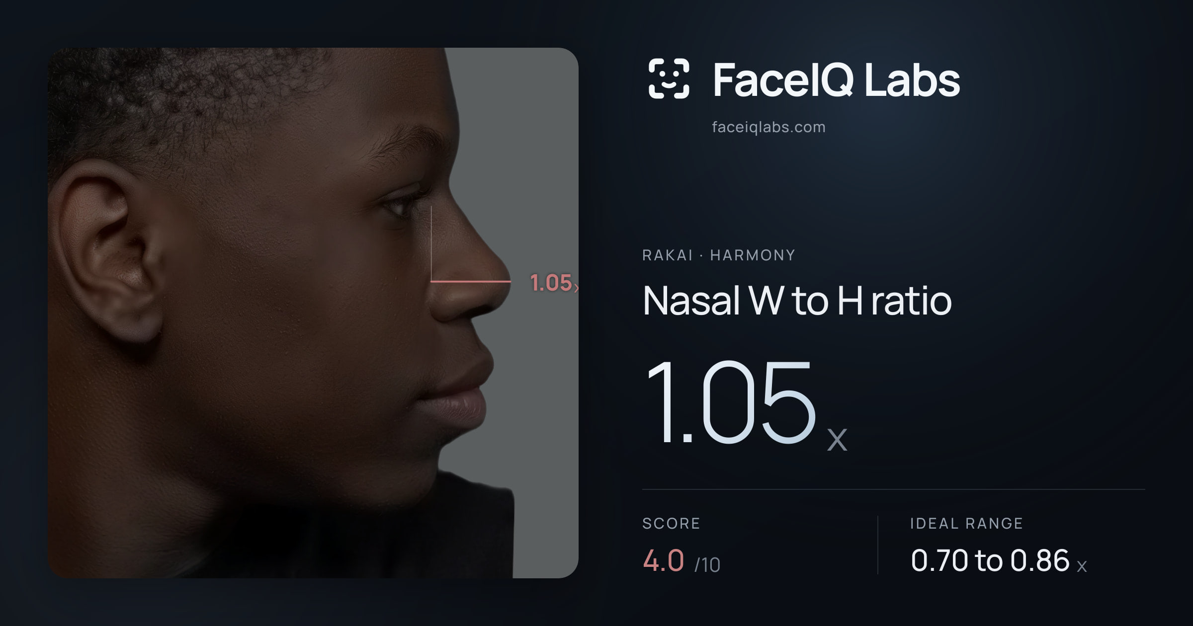 Rakai Nasal W to H ratio: 1.05x, drawn on the photo
