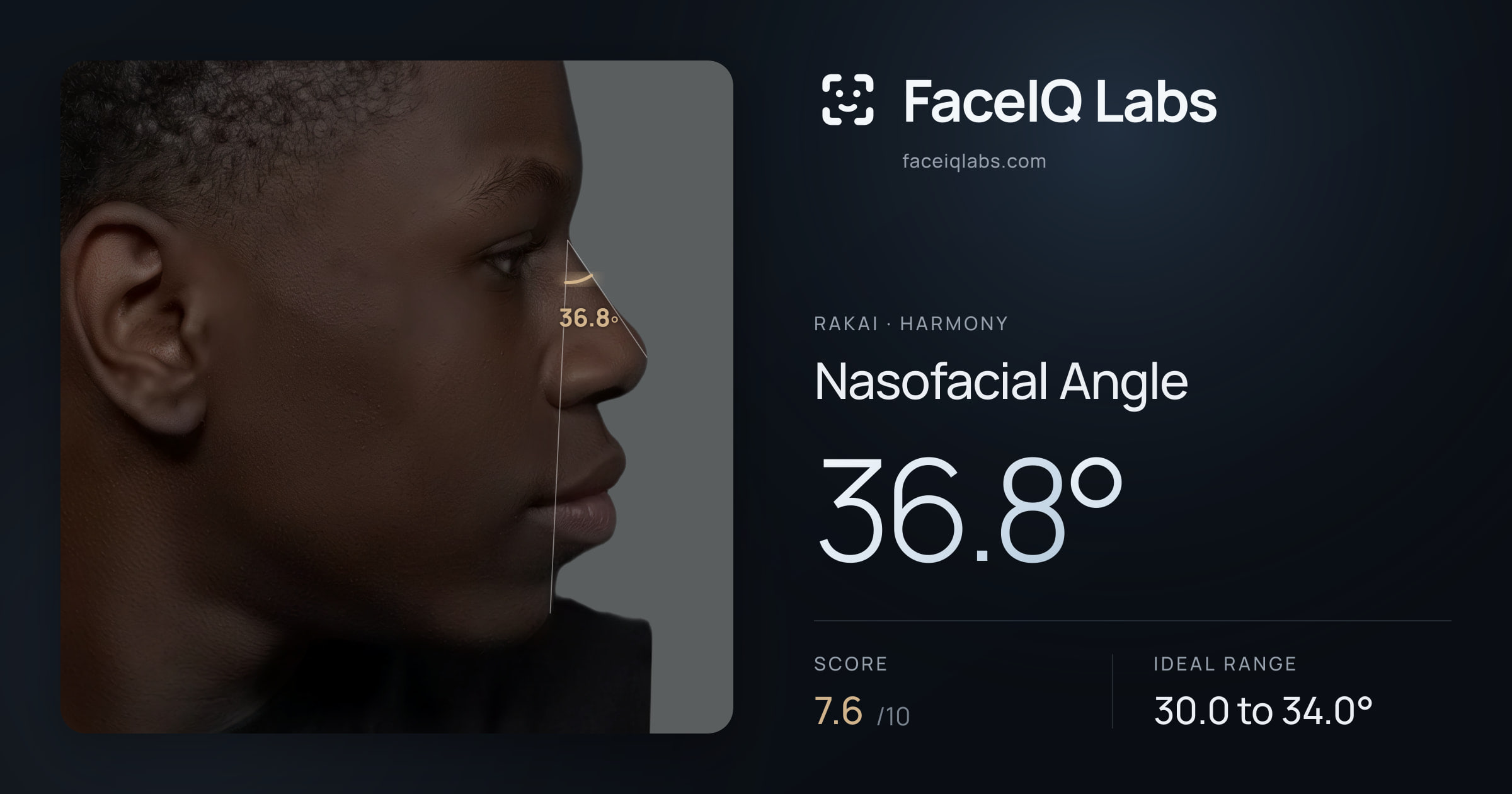 Rakai Nasofacial Angle: 36.8°, drawn on the photo