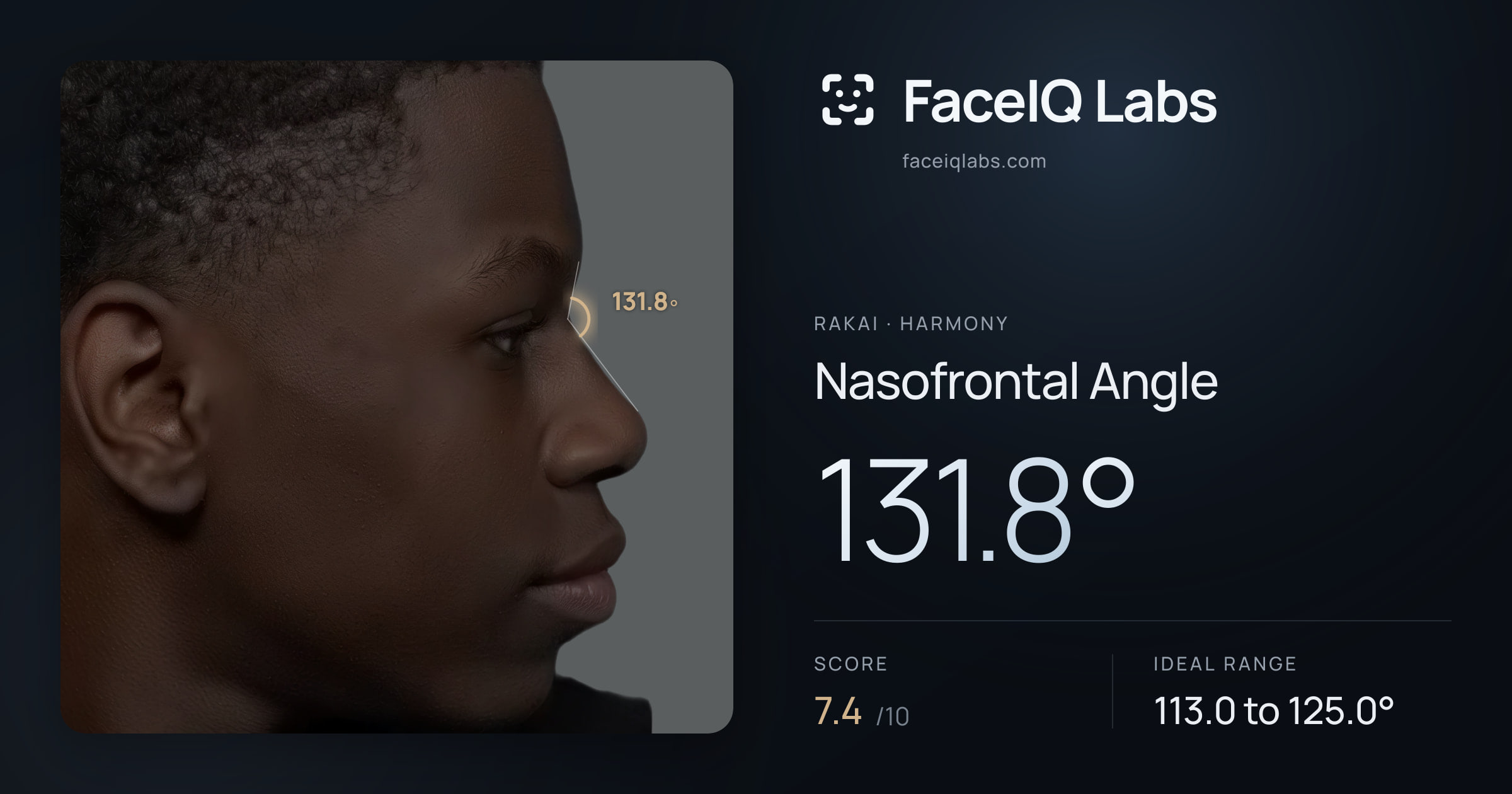 Rakai Nasofrontal Angle: 131.8°, drawn on the photo