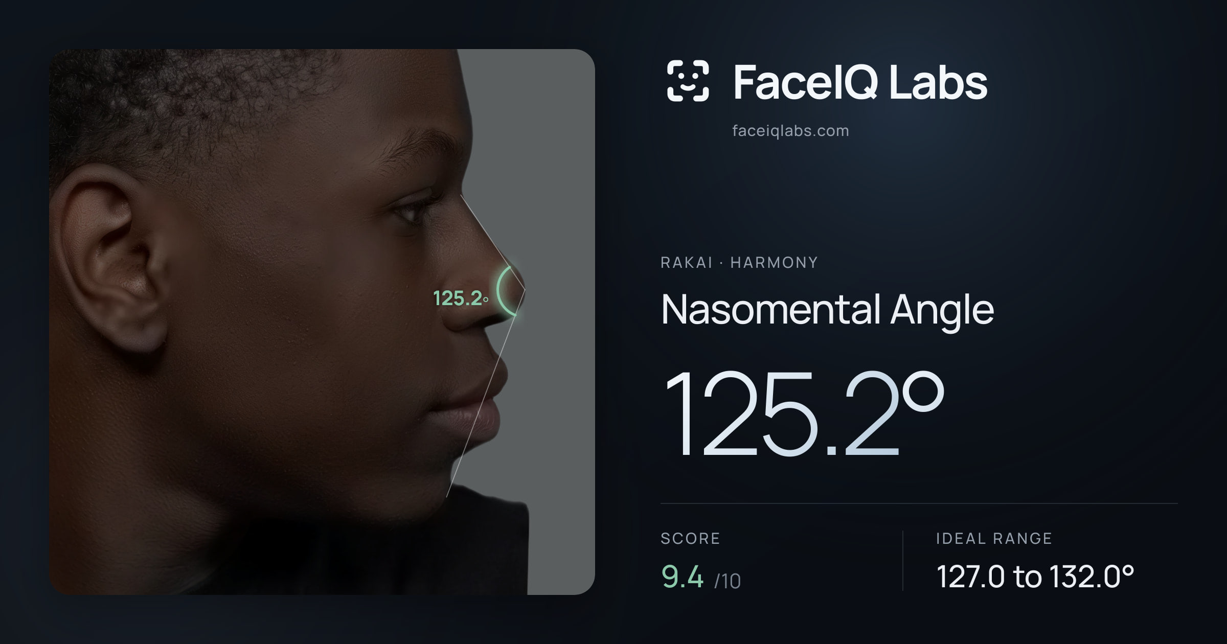Rakai Nasomental Angle: 125.2°, drawn on the photo