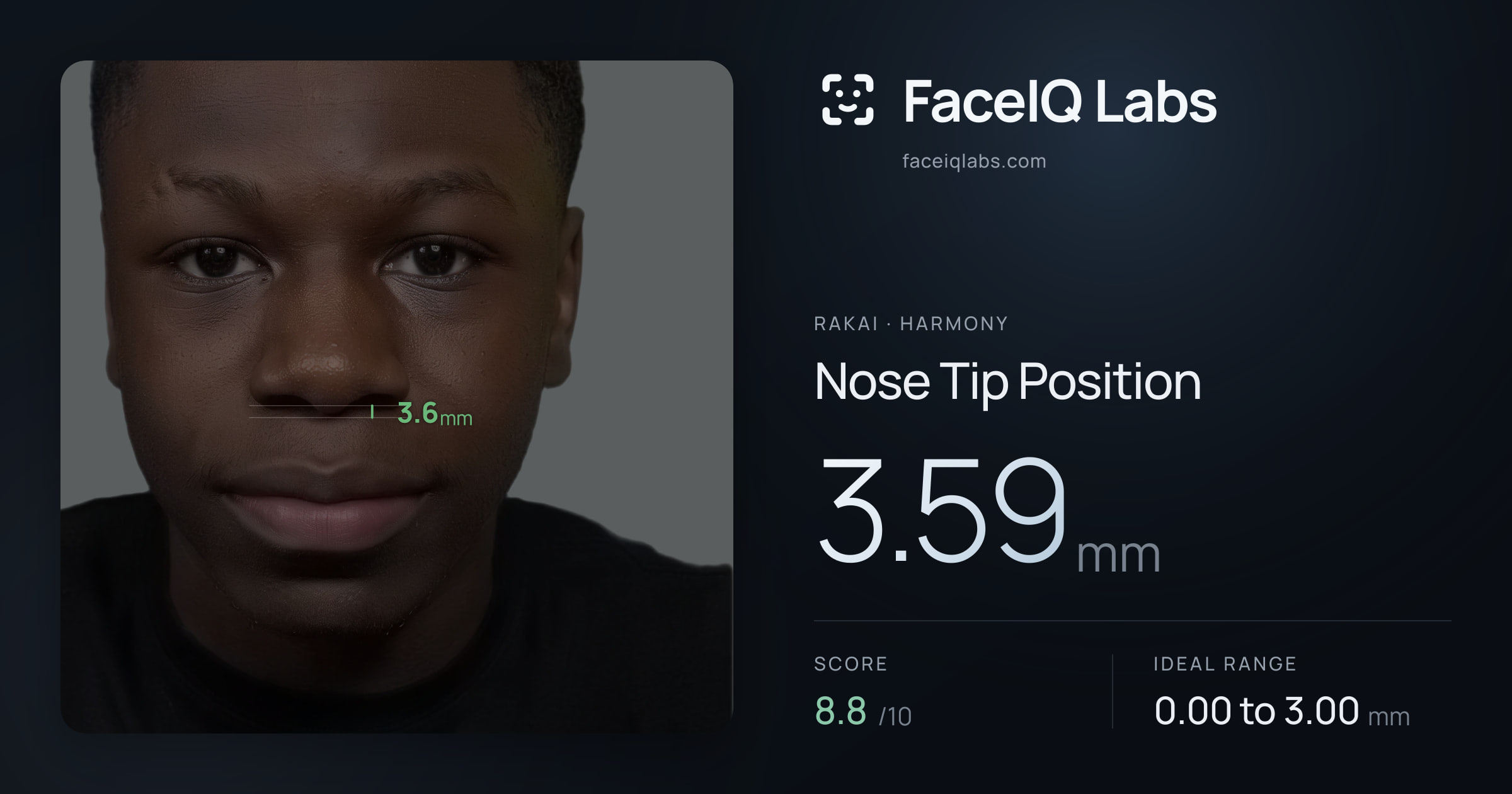 Rakai Nose Tip Position: 3.59mm, drawn on the photo