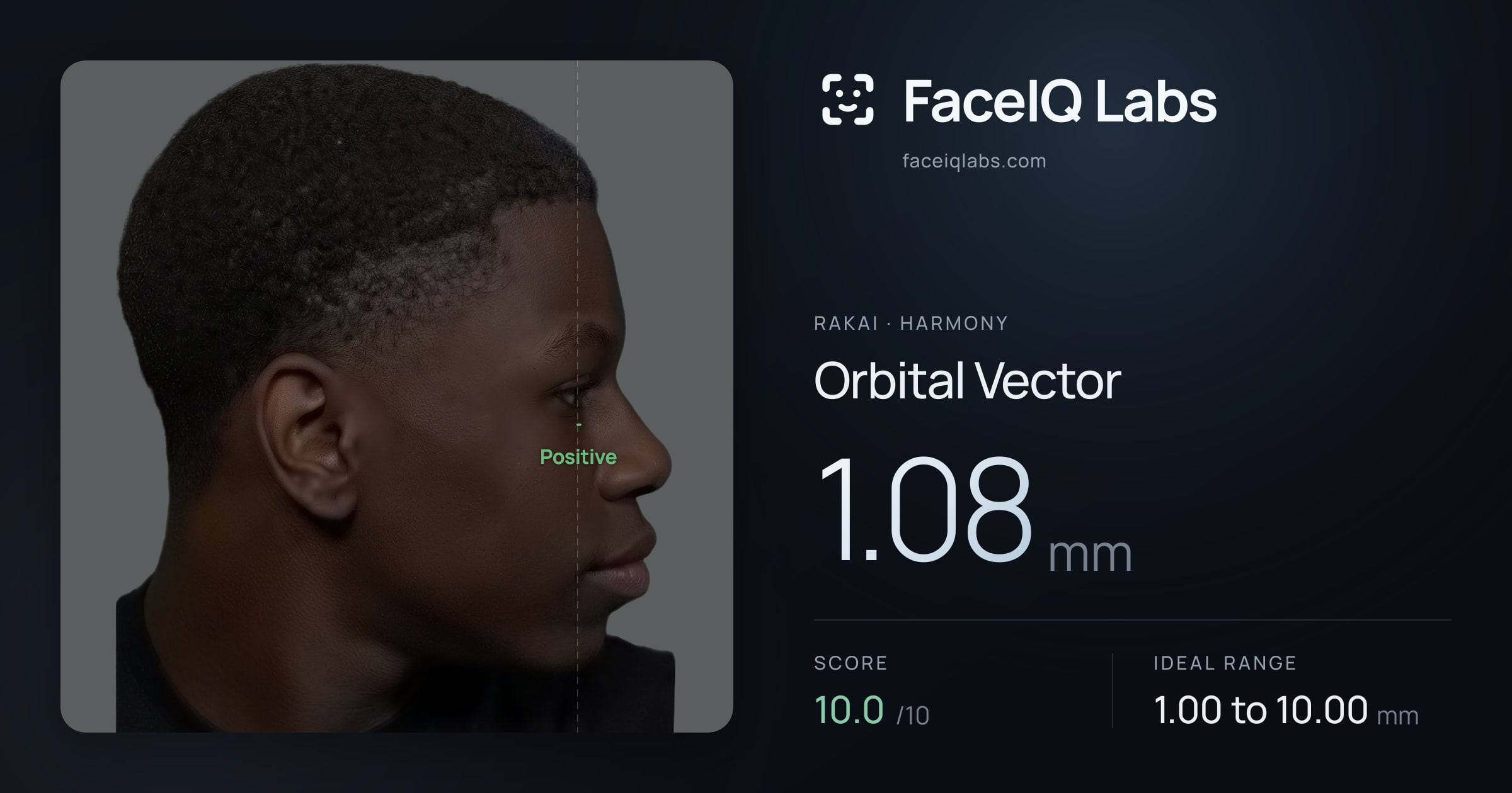 Rakai Orbital Vector: 1.08mm, drawn on the photo