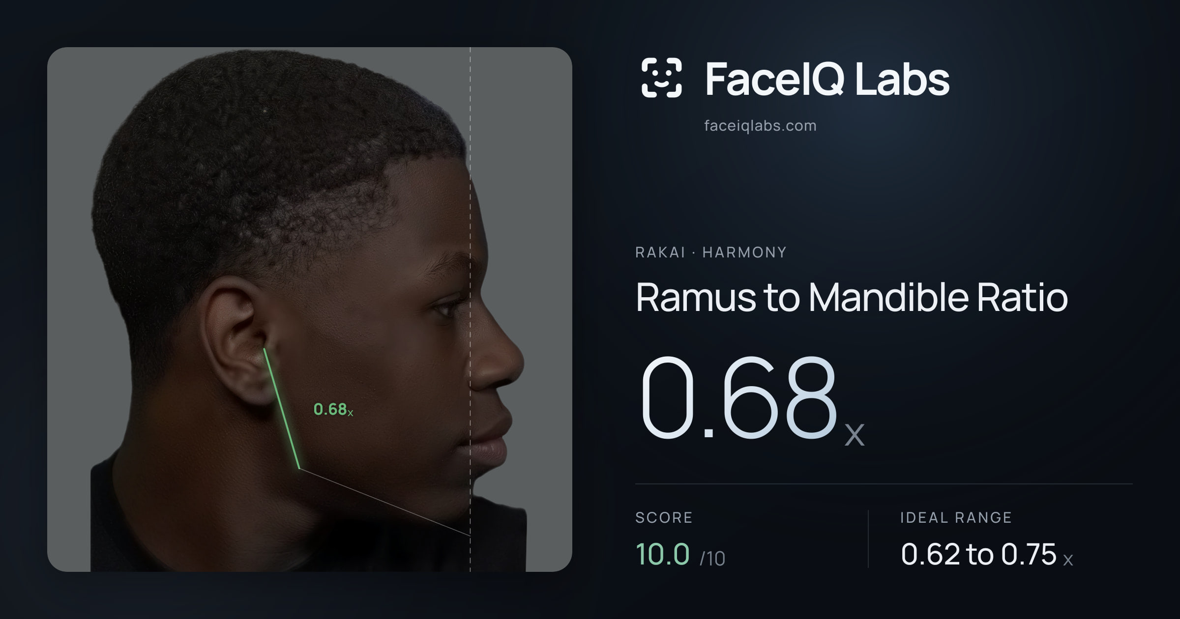 Rakai Ramus to Mandible Ratio: 0.68x, drawn on the photo