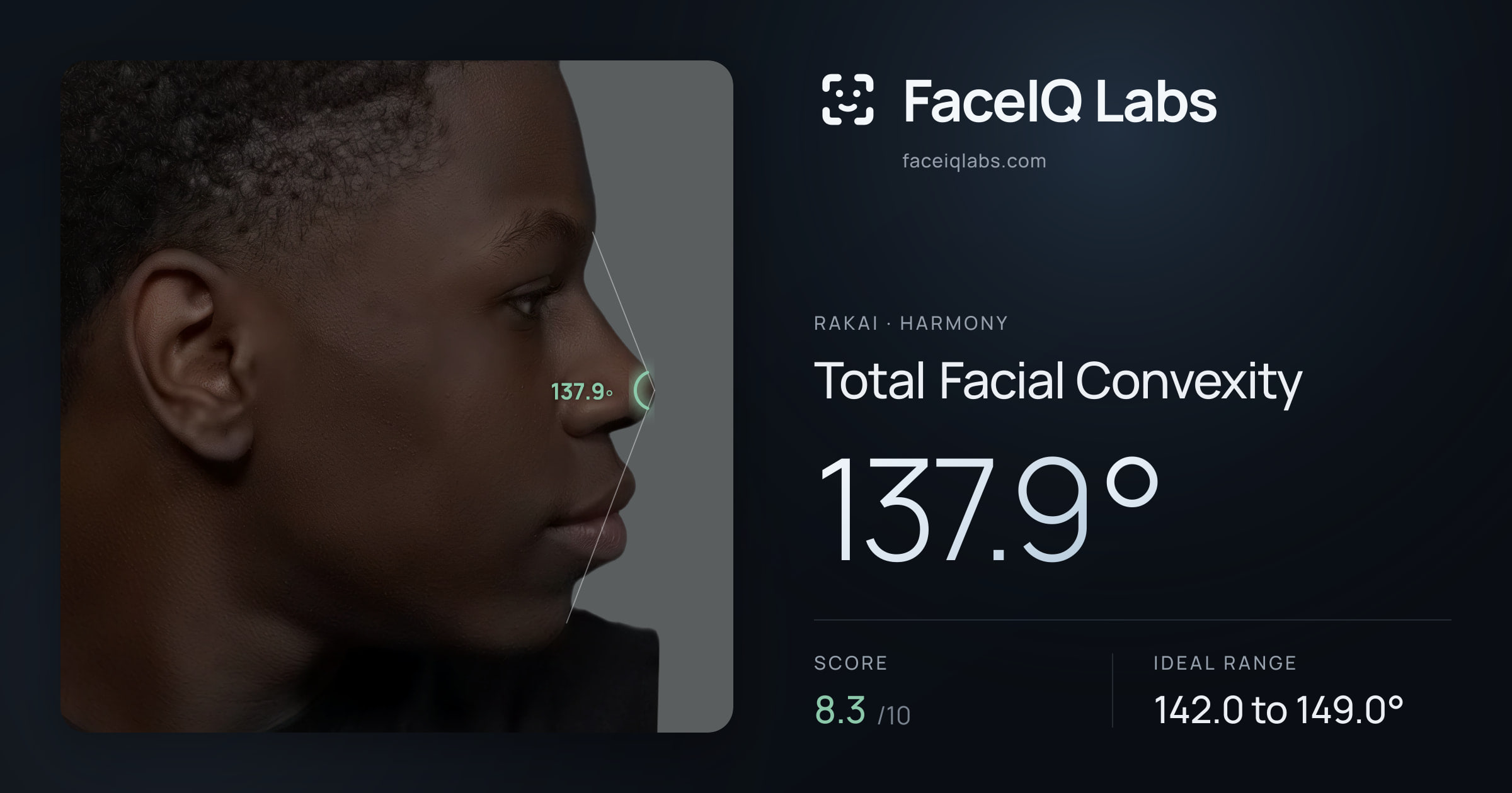 Rakai Total Facial Convexity: 137.9°, drawn on the photo