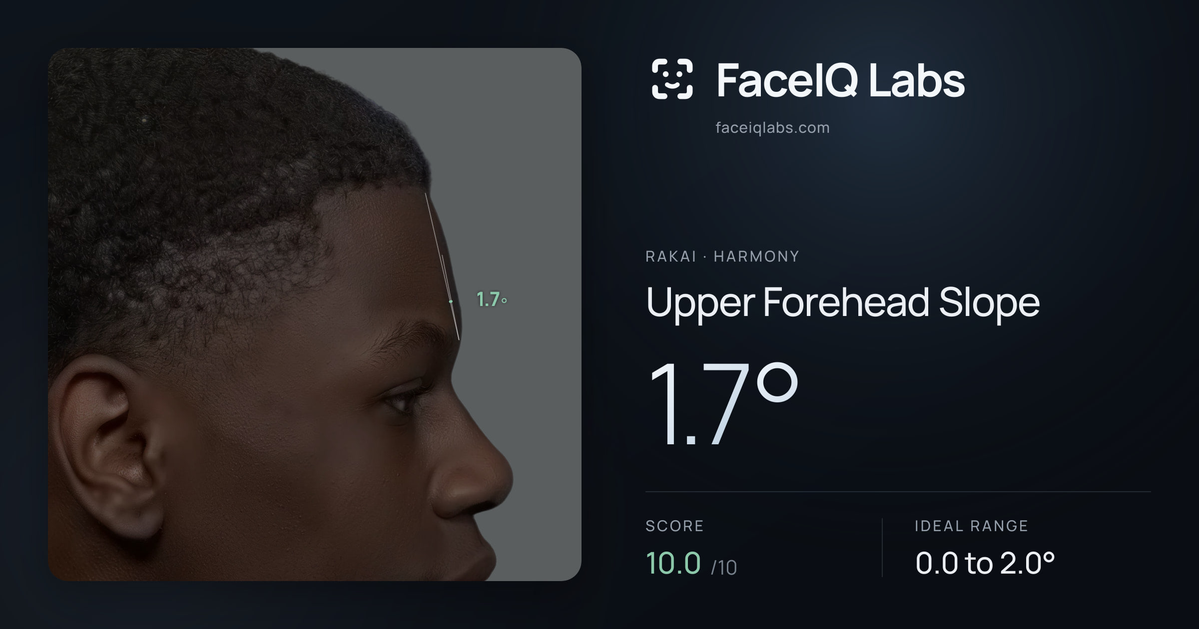 Rakai Upper Forehead Slope: 1.7°, drawn on the photo