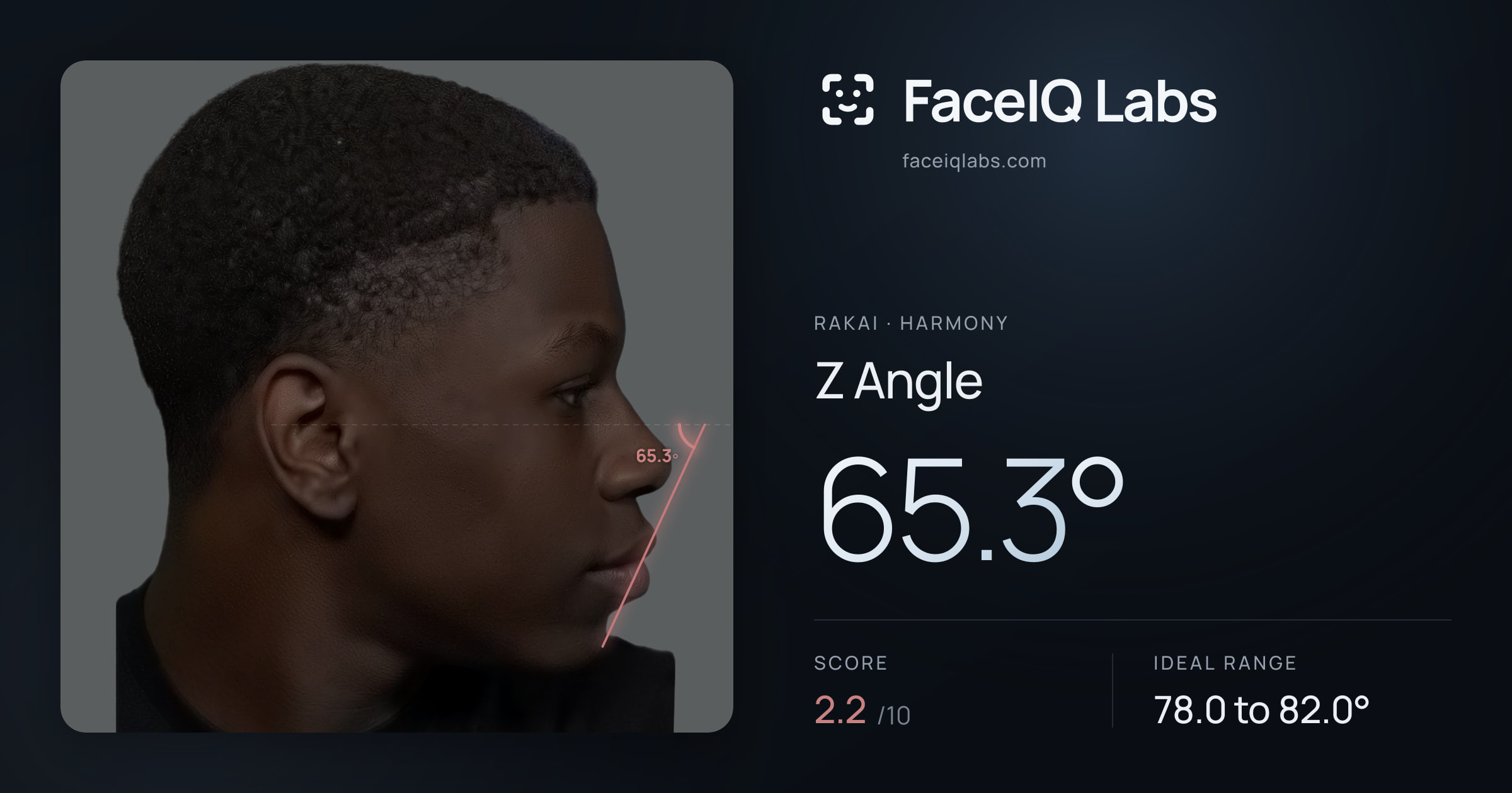 Rakai Z Angle: 65.3°, drawn on the photo
