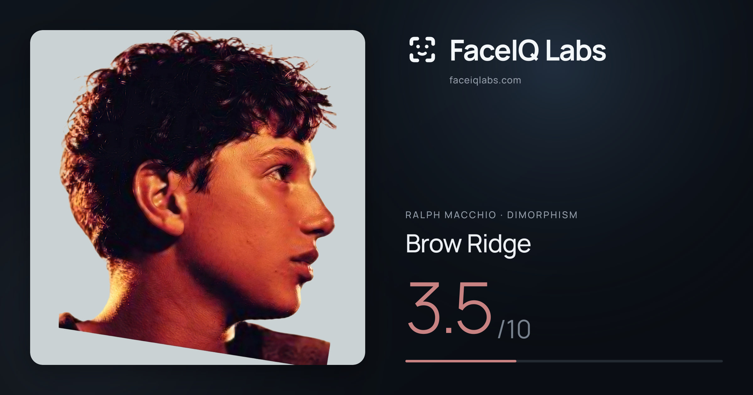 Ralph Macchio Brow Ridge: 3.5/10, drawn on the photo