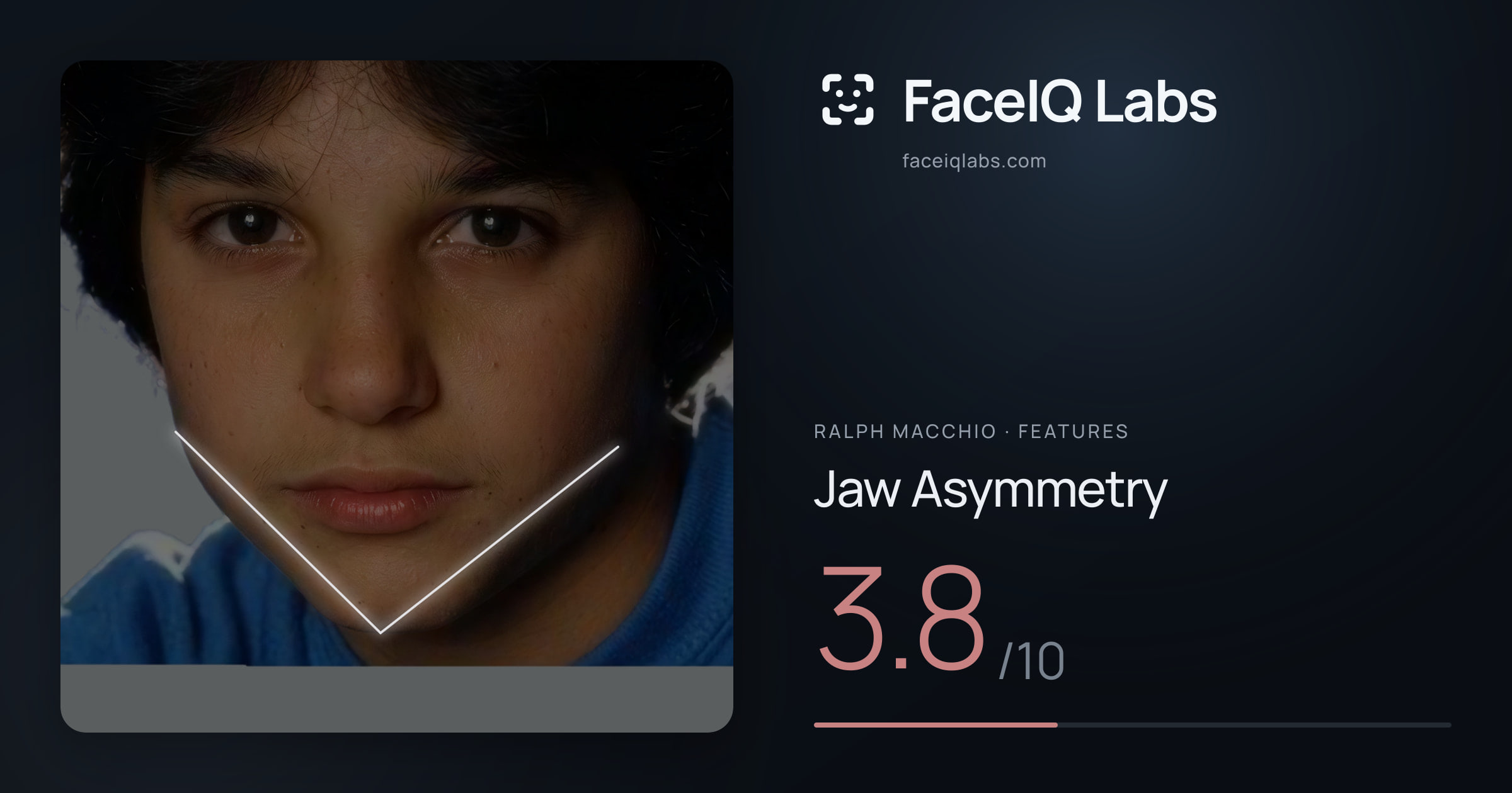 Ralph Macchio Jaw Asymmetry: 3.8/10, drawn on the photo