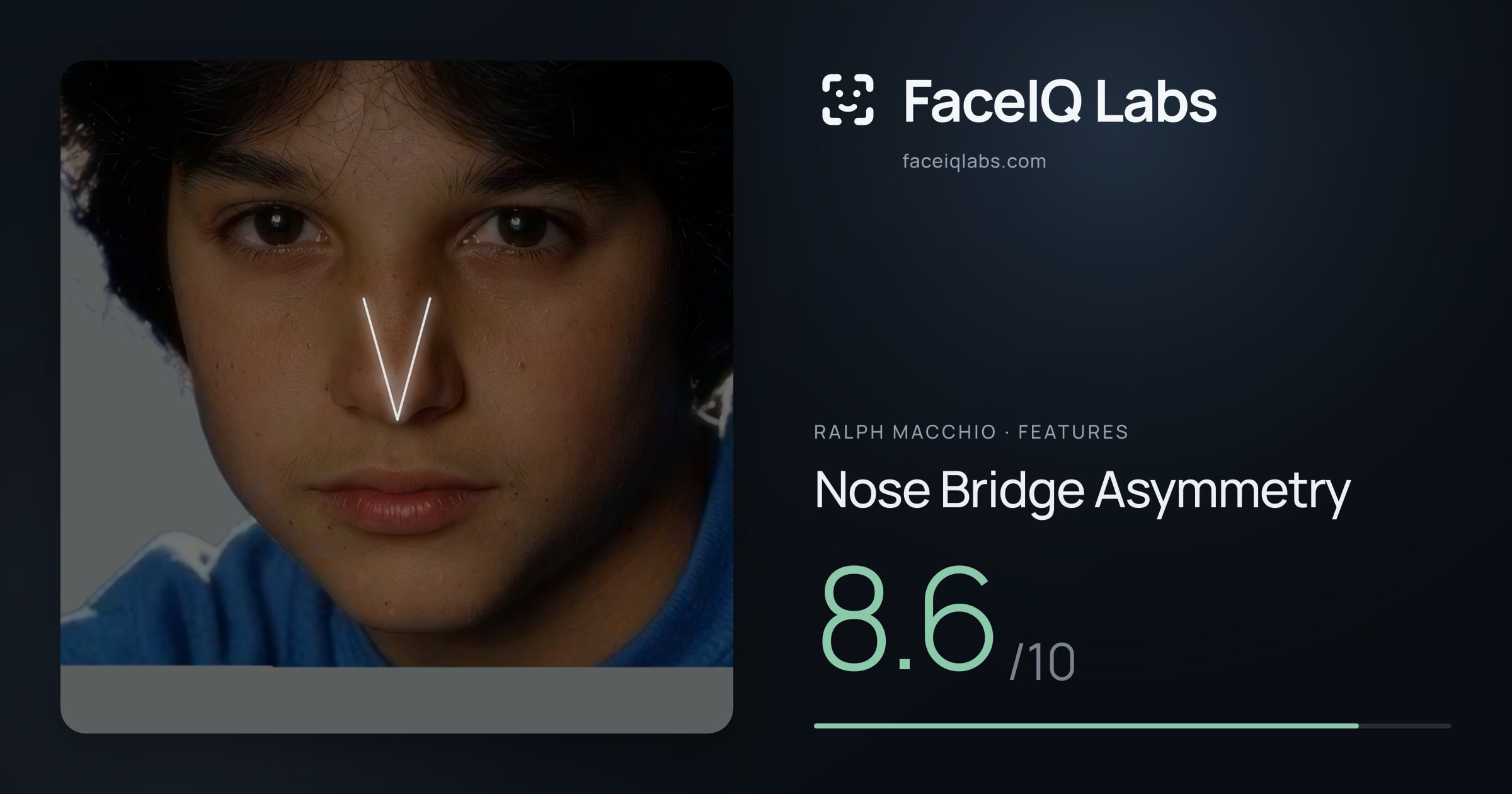 Ralph Macchio Nose Bridge Asymmetry: 8.6/10, drawn on the photo