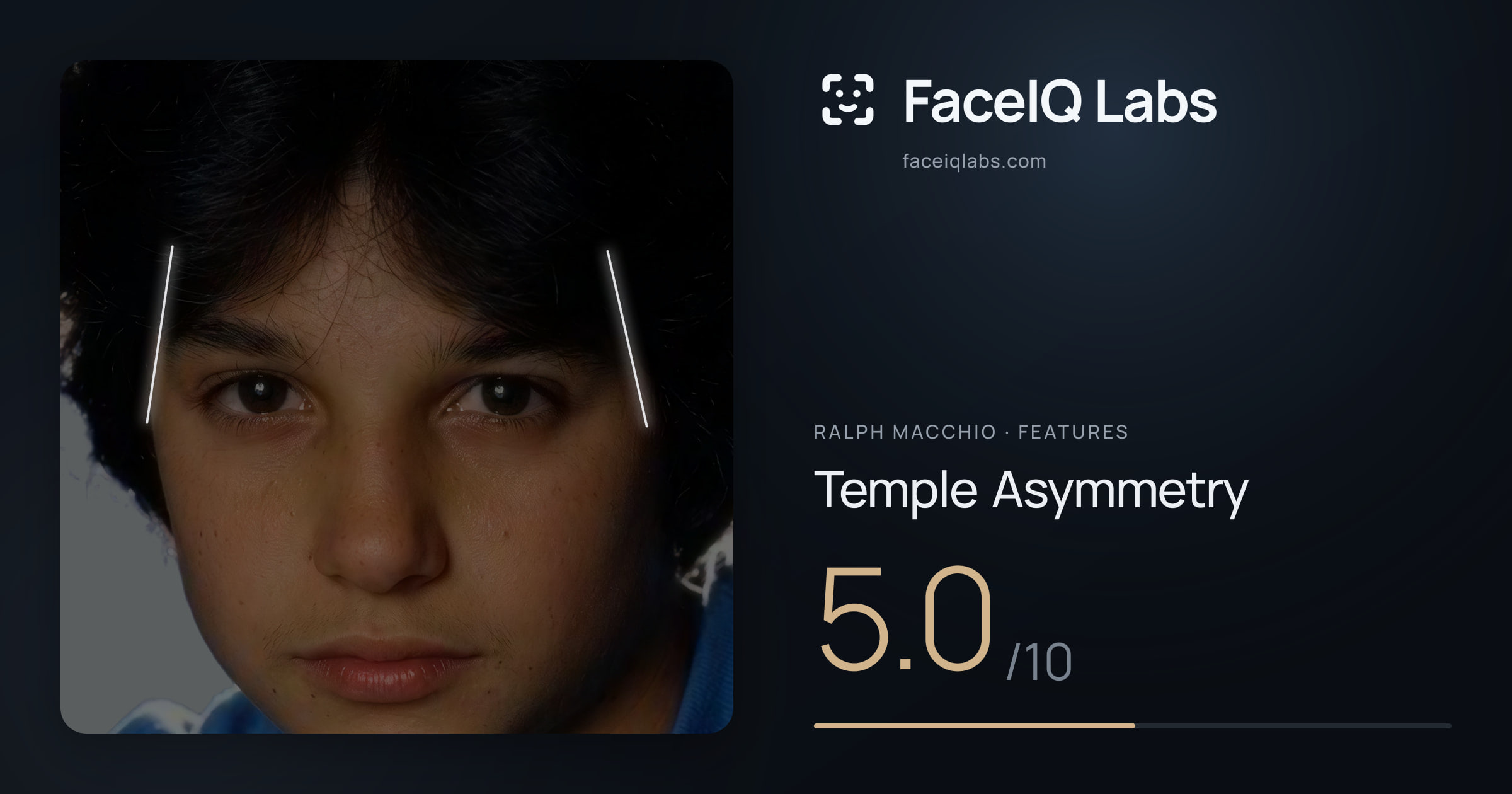 Ralph Macchio Temple Asymmetry: 5.0/10, drawn on the photo