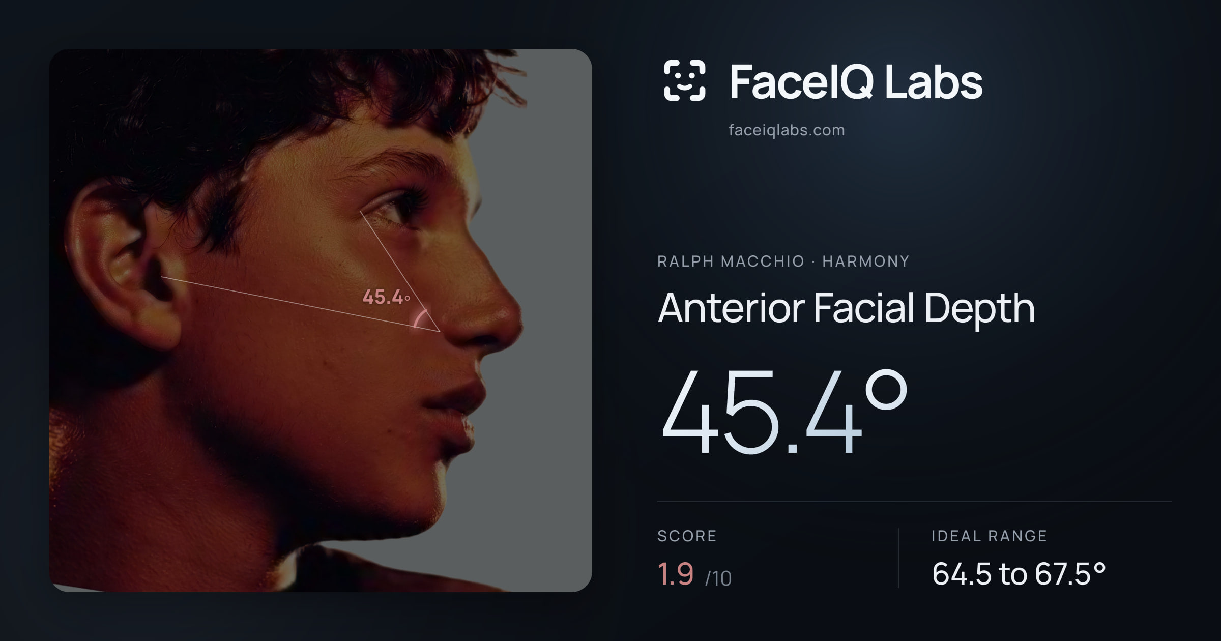 Ralph Macchio Anterior Facial Depth: 45.4°, drawn on the photo