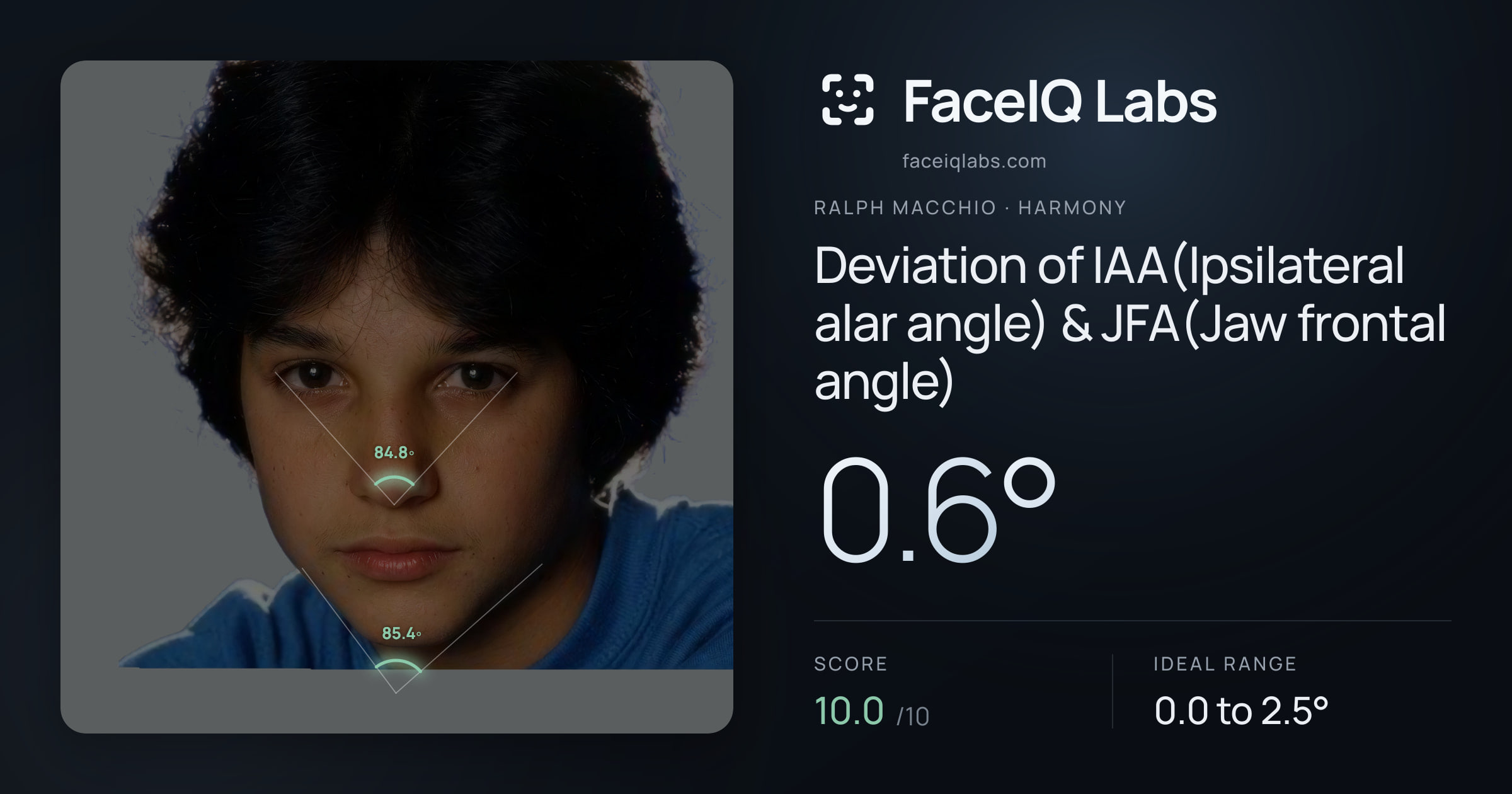 Ralph Macchio Deviation of IAA(Ipsilateral alar angle) & JFA(Jaw frontal angle): 0.6°, drawn on the photo