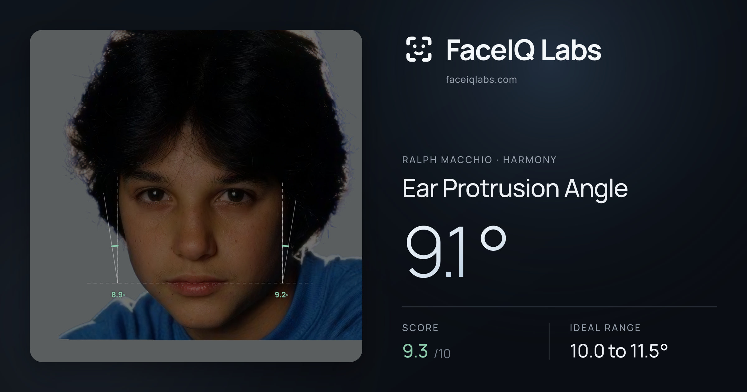 Ralph Macchio Ear Protrusion Angle: 9.1°, drawn on the photo