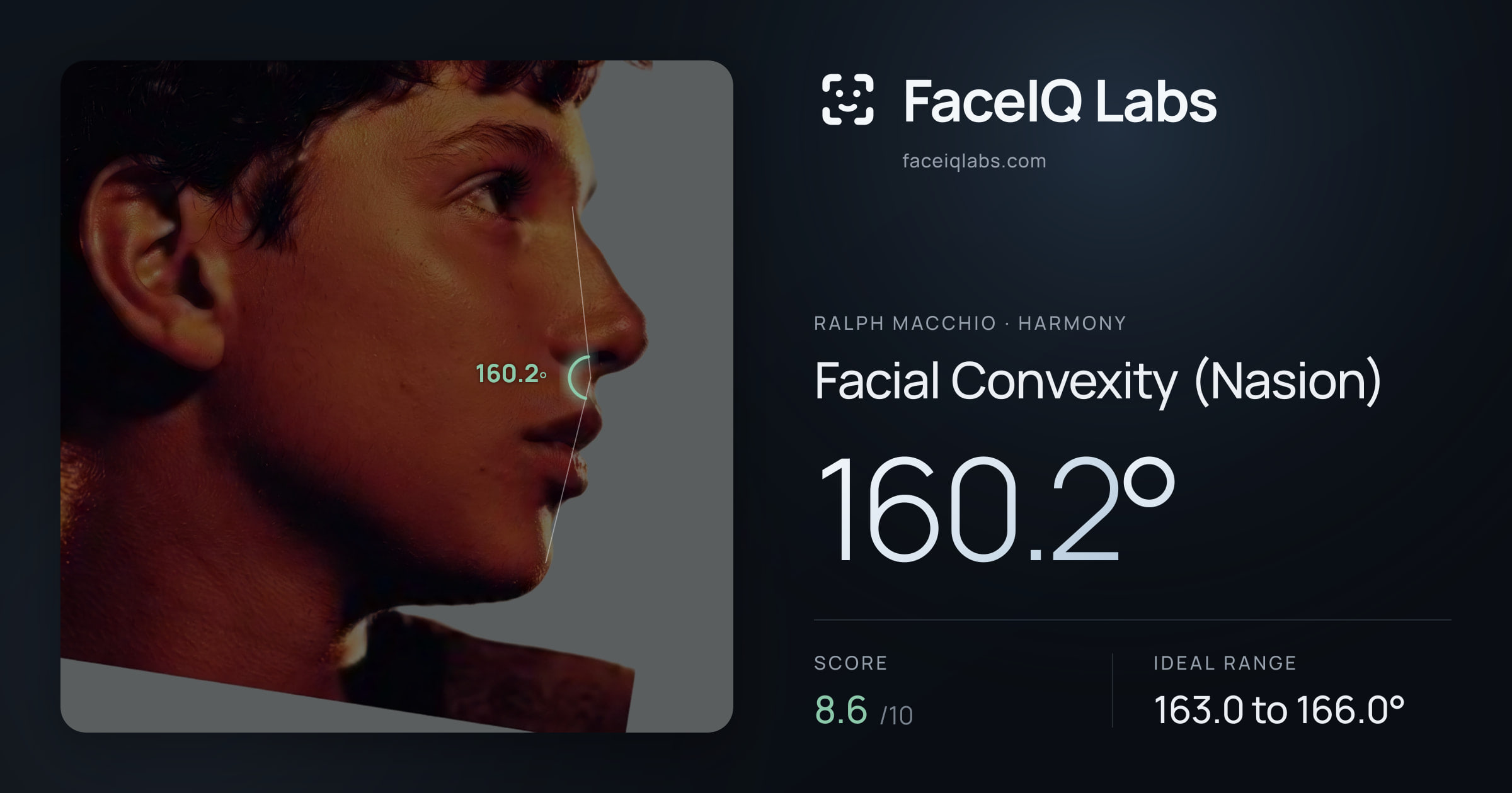 Ralph Macchio Facial Convexity (Nasion): 160.2°, drawn on the photo