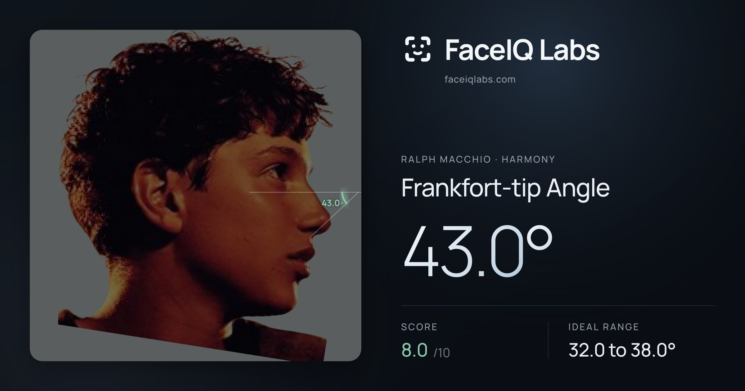 Ralph Macchio Frankfort-tip Angle: 43.0°, drawn on the photo