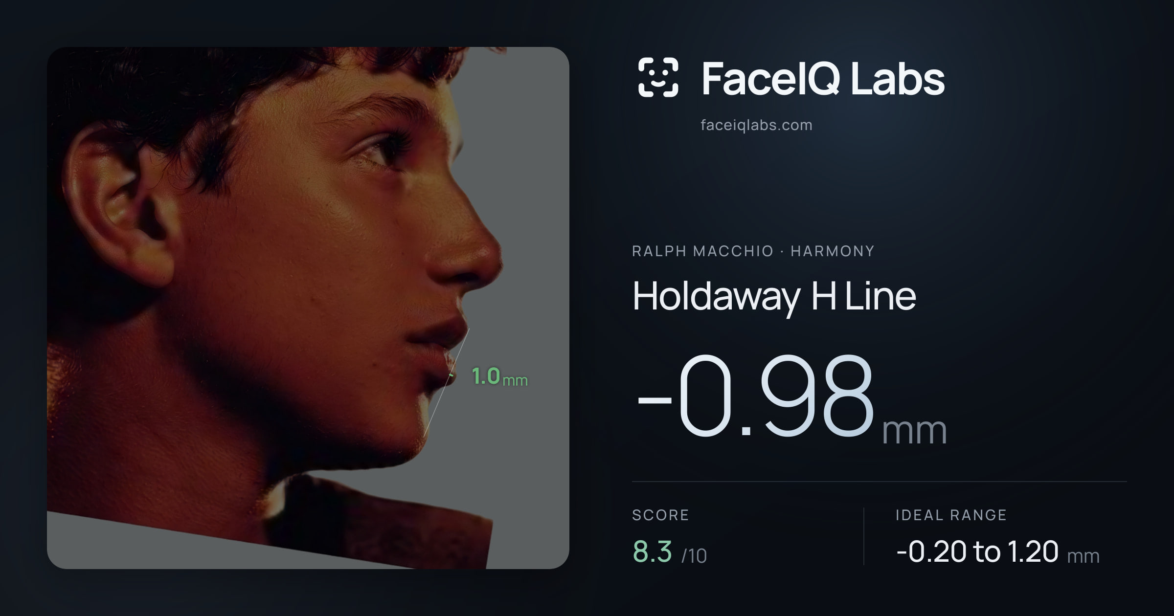 Ralph Macchio Holdaway H Line: -0.98mm, drawn on the photo