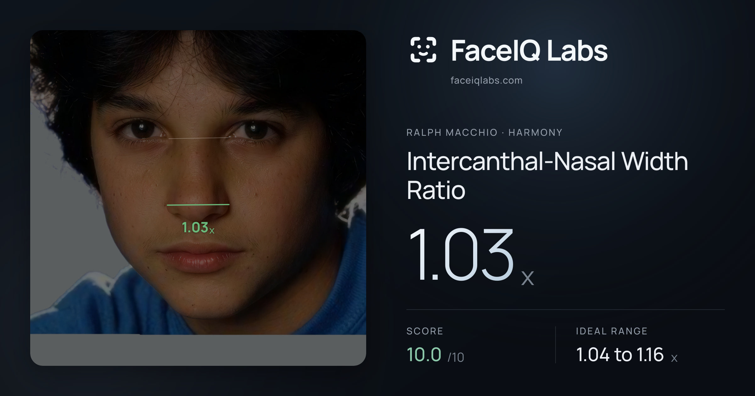 Ralph Macchio Intercanthal-Nasal Width Ratio: 1.03x, drawn on the photo