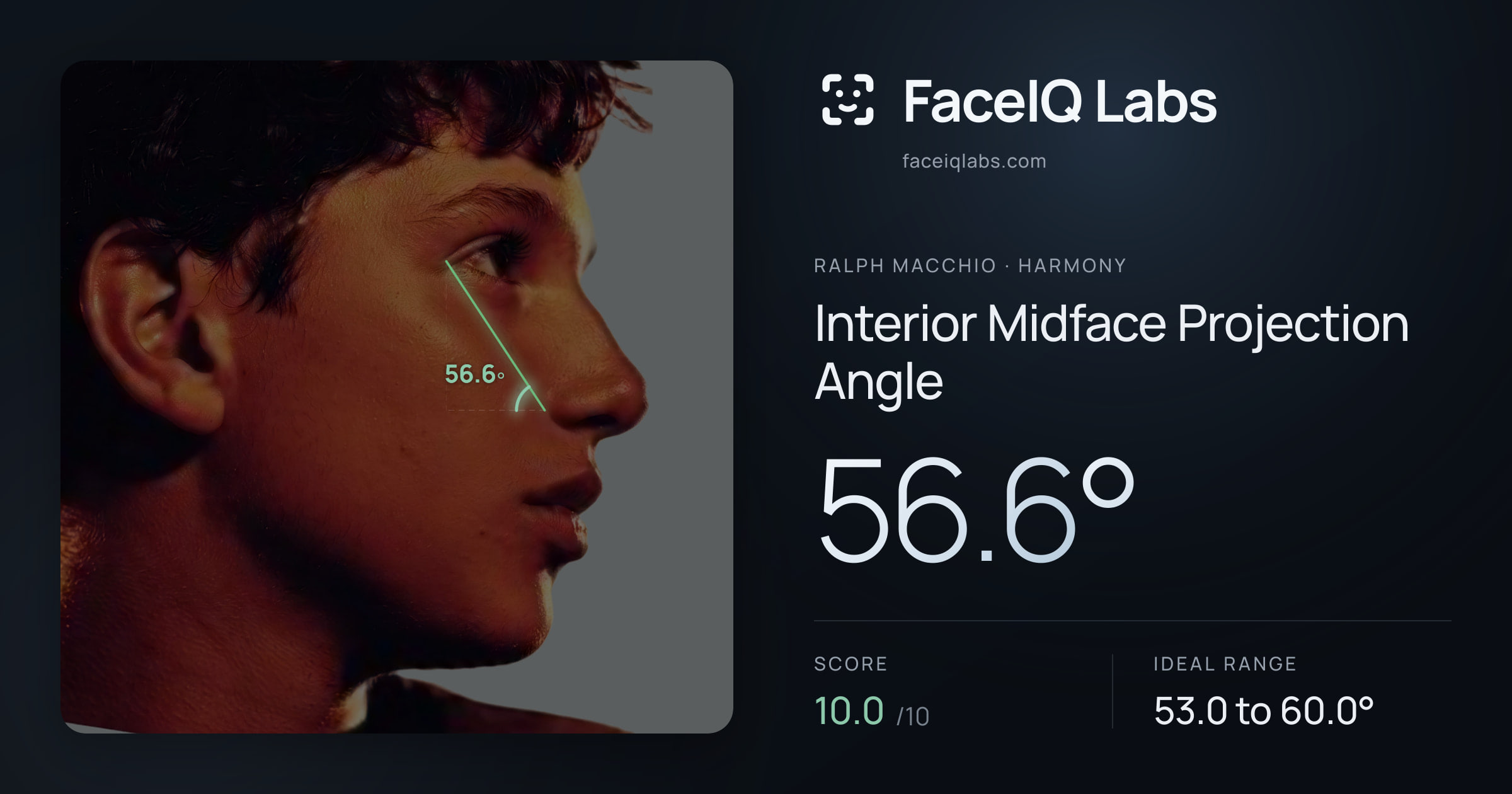 Ralph Macchio Interior Midface Projection Angle: 56.6°, drawn on the photo
