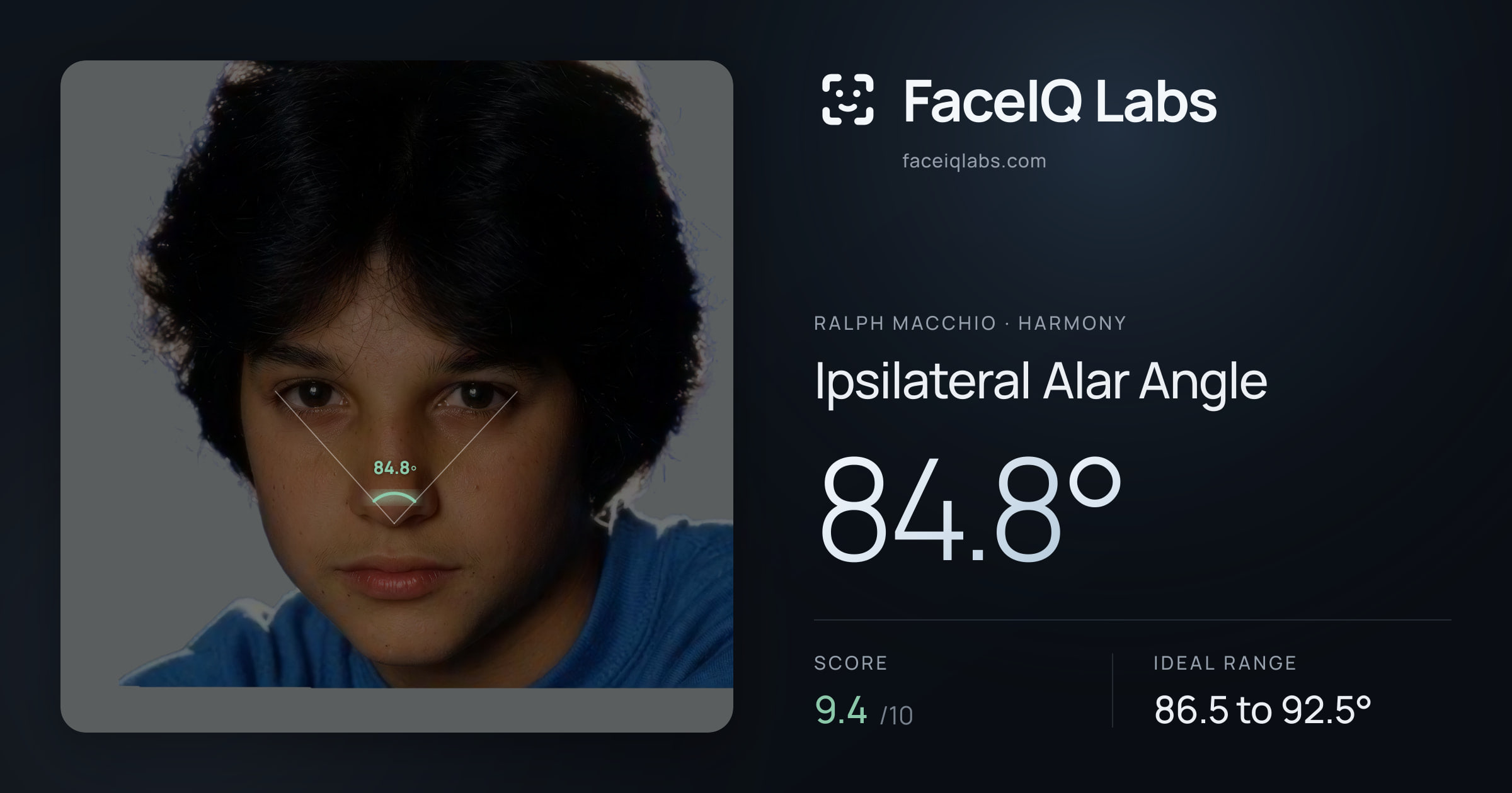 Ralph Macchio Ipsilateral Alar Angle: 84.8°, drawn on the photo