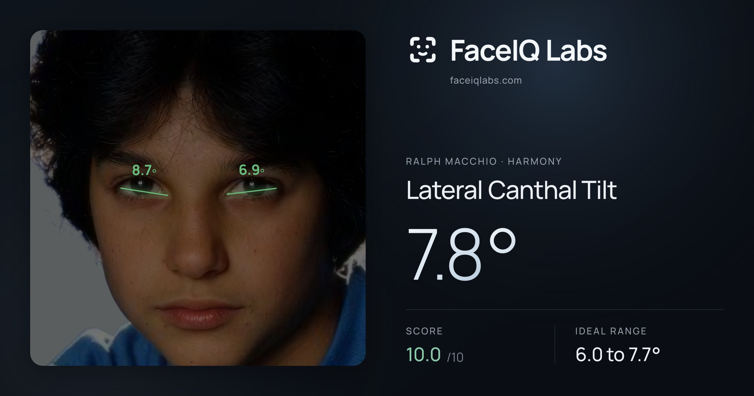 Ralph Macchio Lateral Canthal Tilt: 7.8°, drawn on the photo