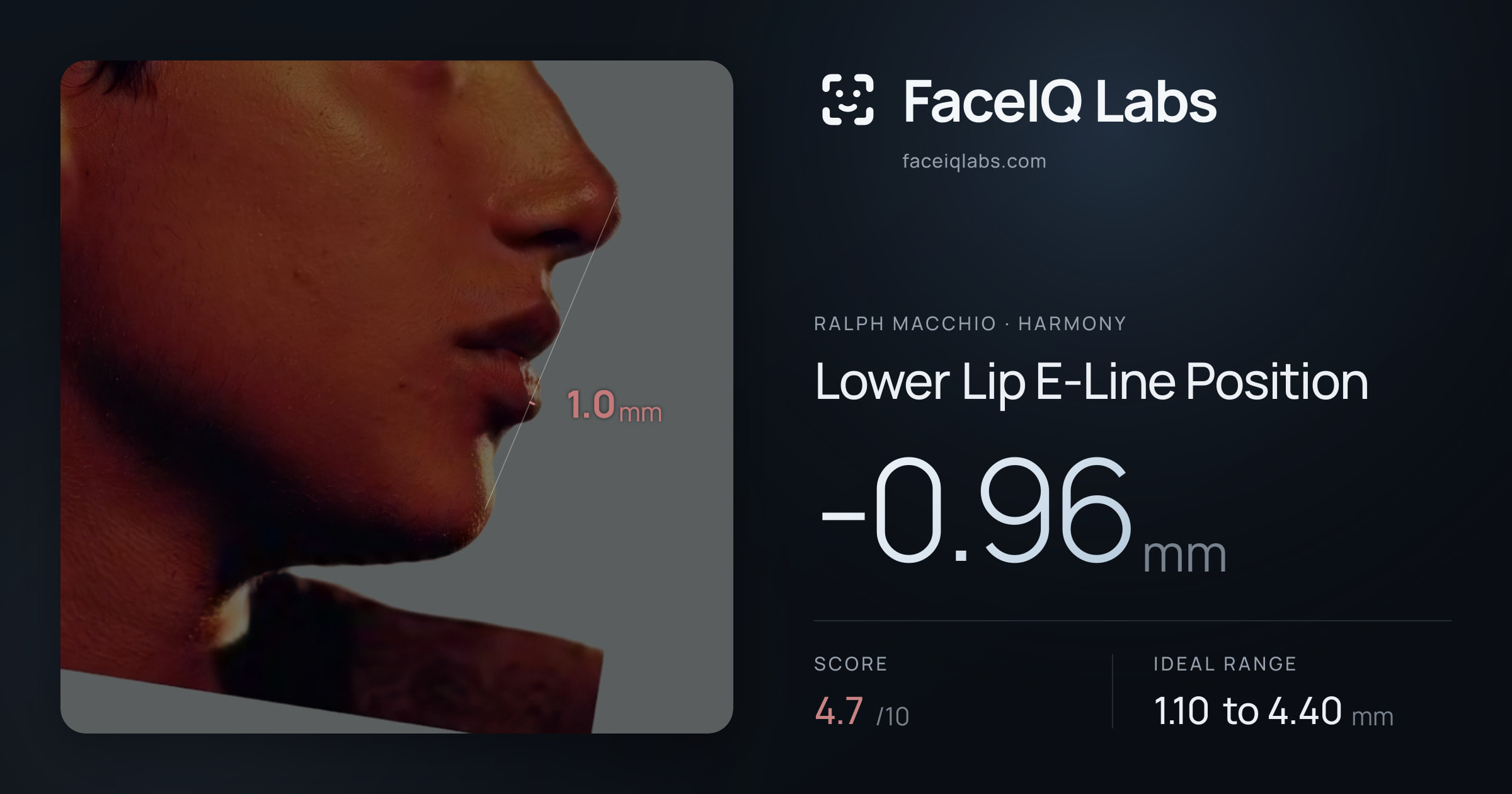 Ralph Macchio Lower Lip E-Line Position: -0.96mm, drawn on the photo