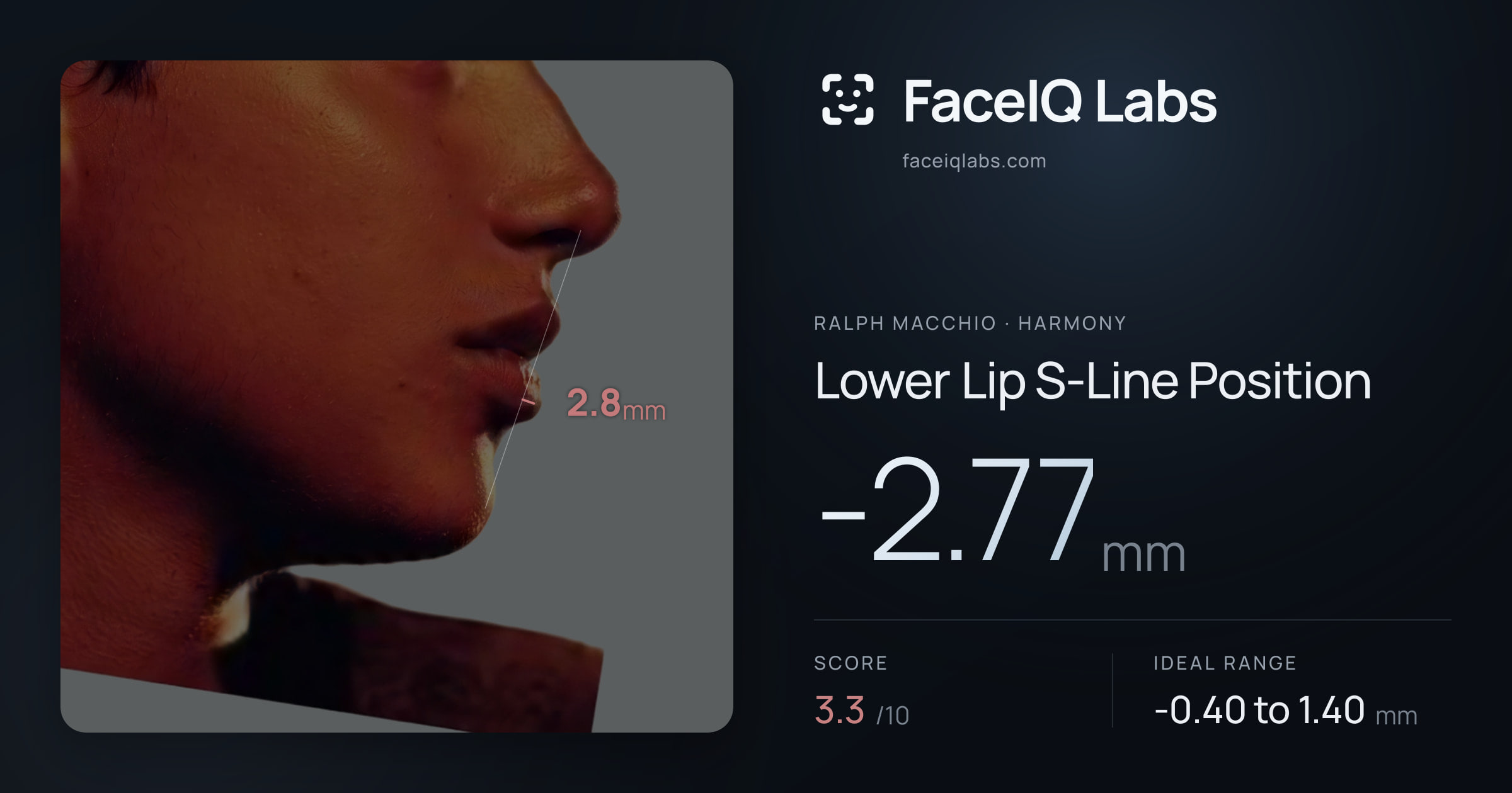 Ralph Macchio Lower Lip S-Line Position: -2.77mm, drawn on the photo