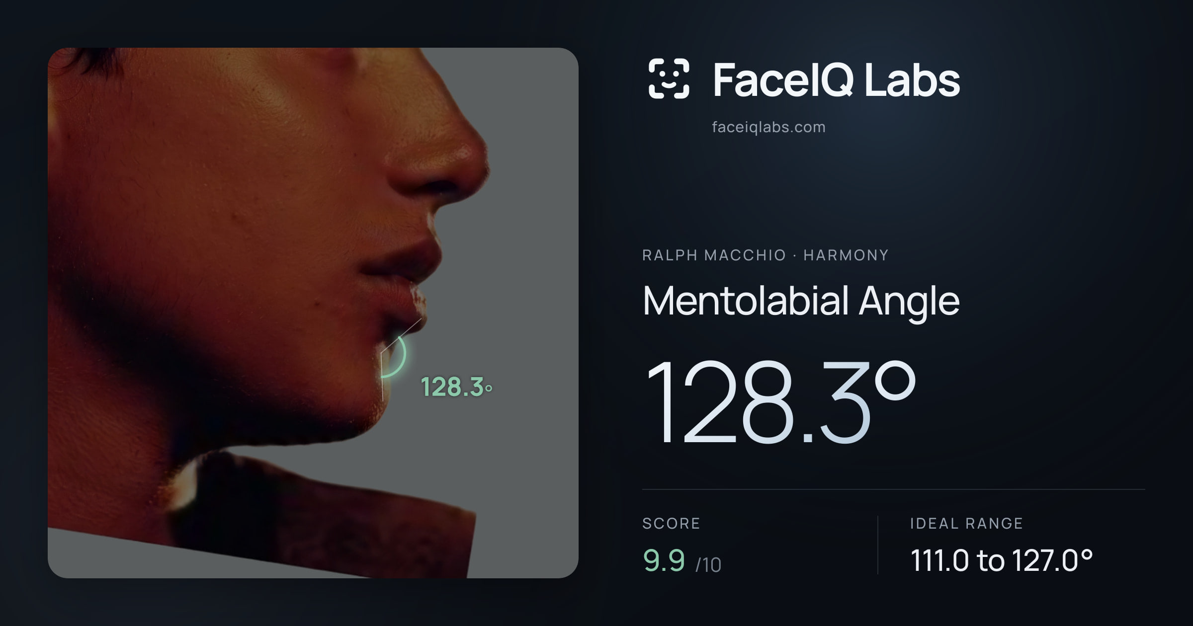 Ralph Macchio Mentolabial Angle: 128.3°, drawn on the photo