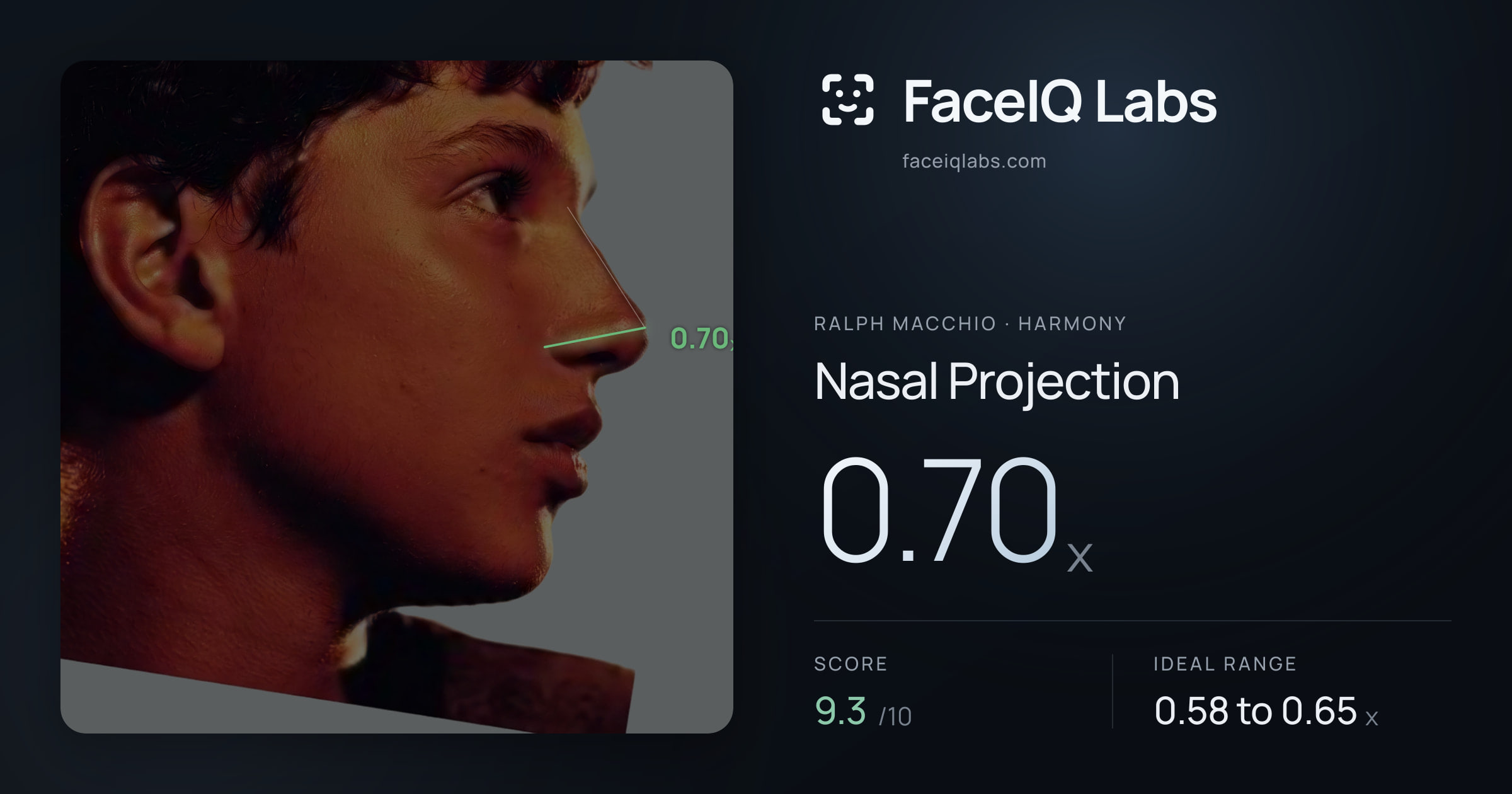 Ralph Macchio Nasal Projection: 0.70x, drawn on the photo