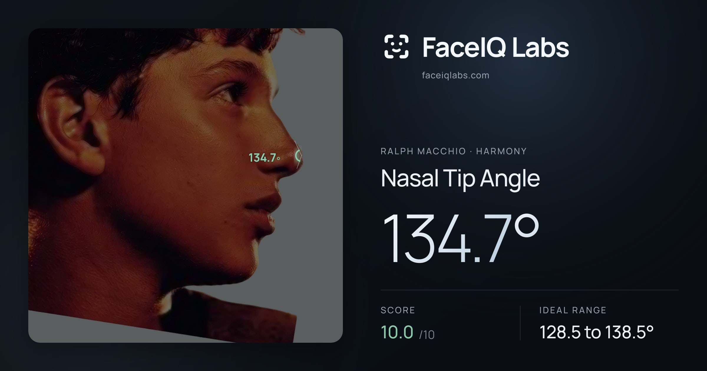 Ralph Macchio Nasal Tip Angle: 134.7°, drawn on the photo