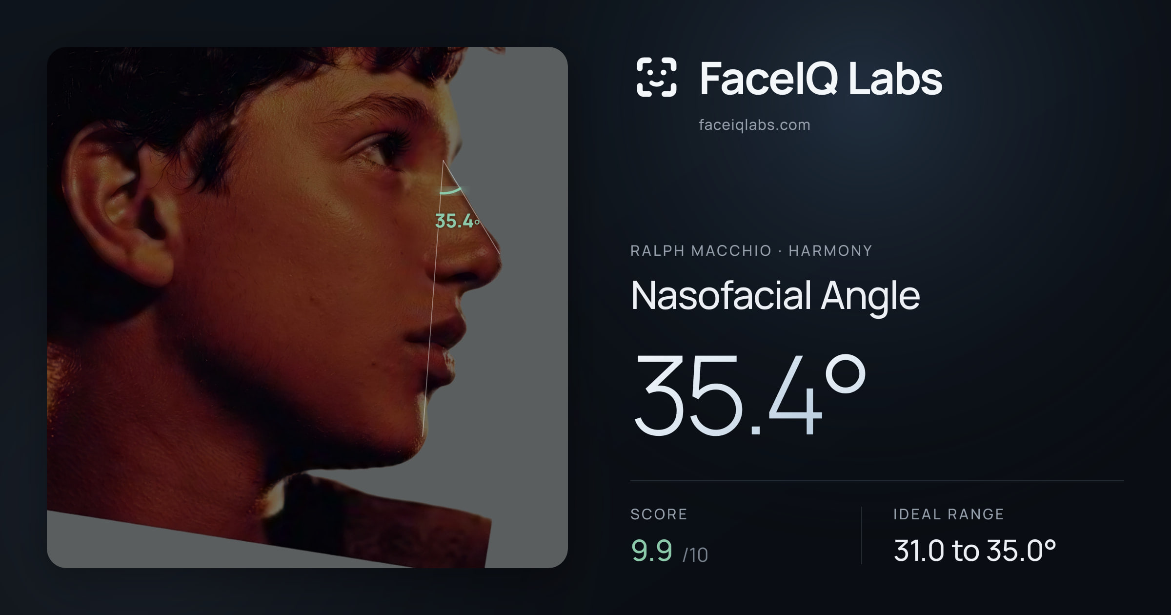 Ralph Macchio Nasofacial Angle: 35.4°, drawn on the photo