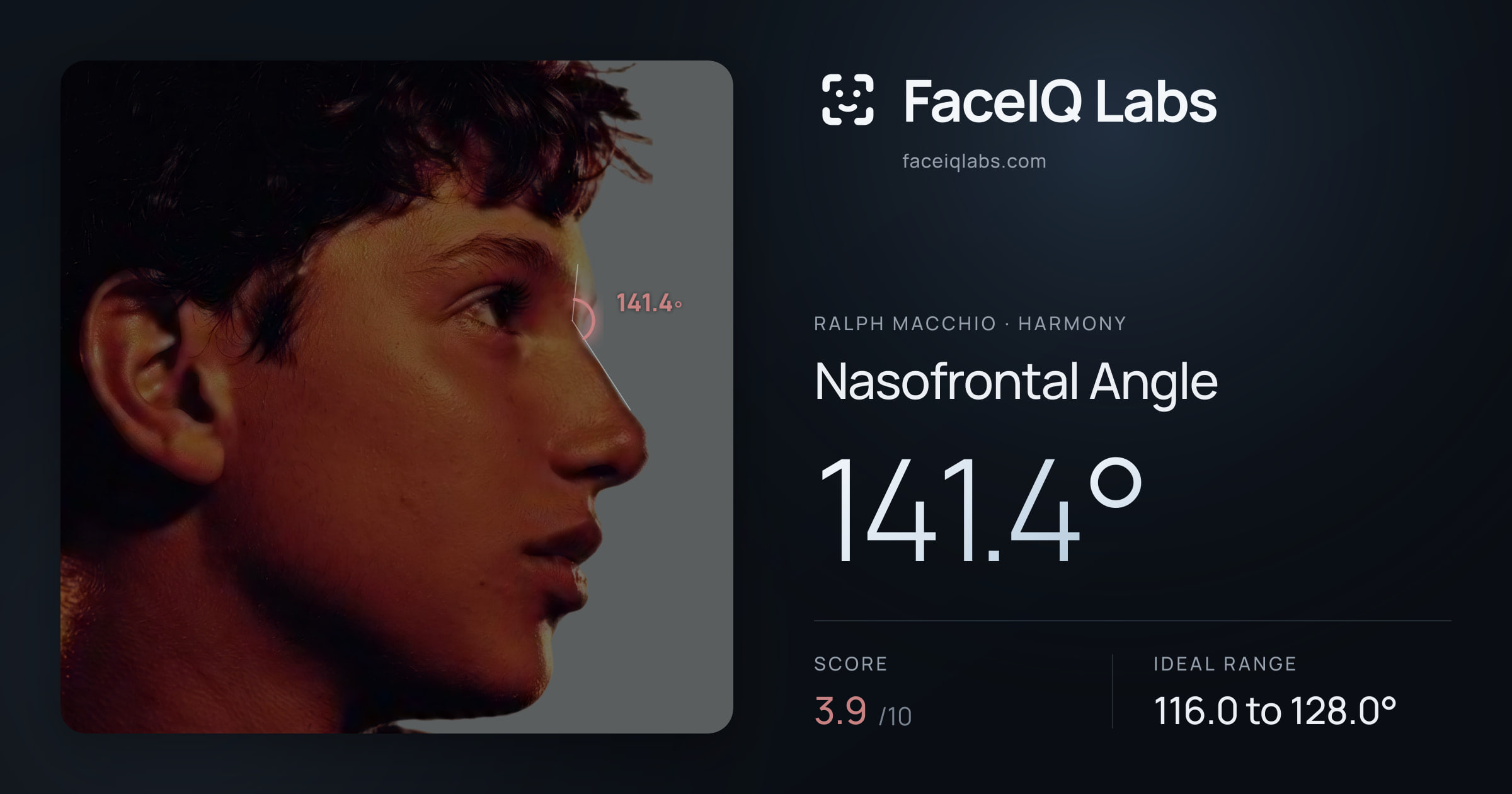 Ralph Macchio Nasofrontal Angle: 141.4°, drawn on the photo