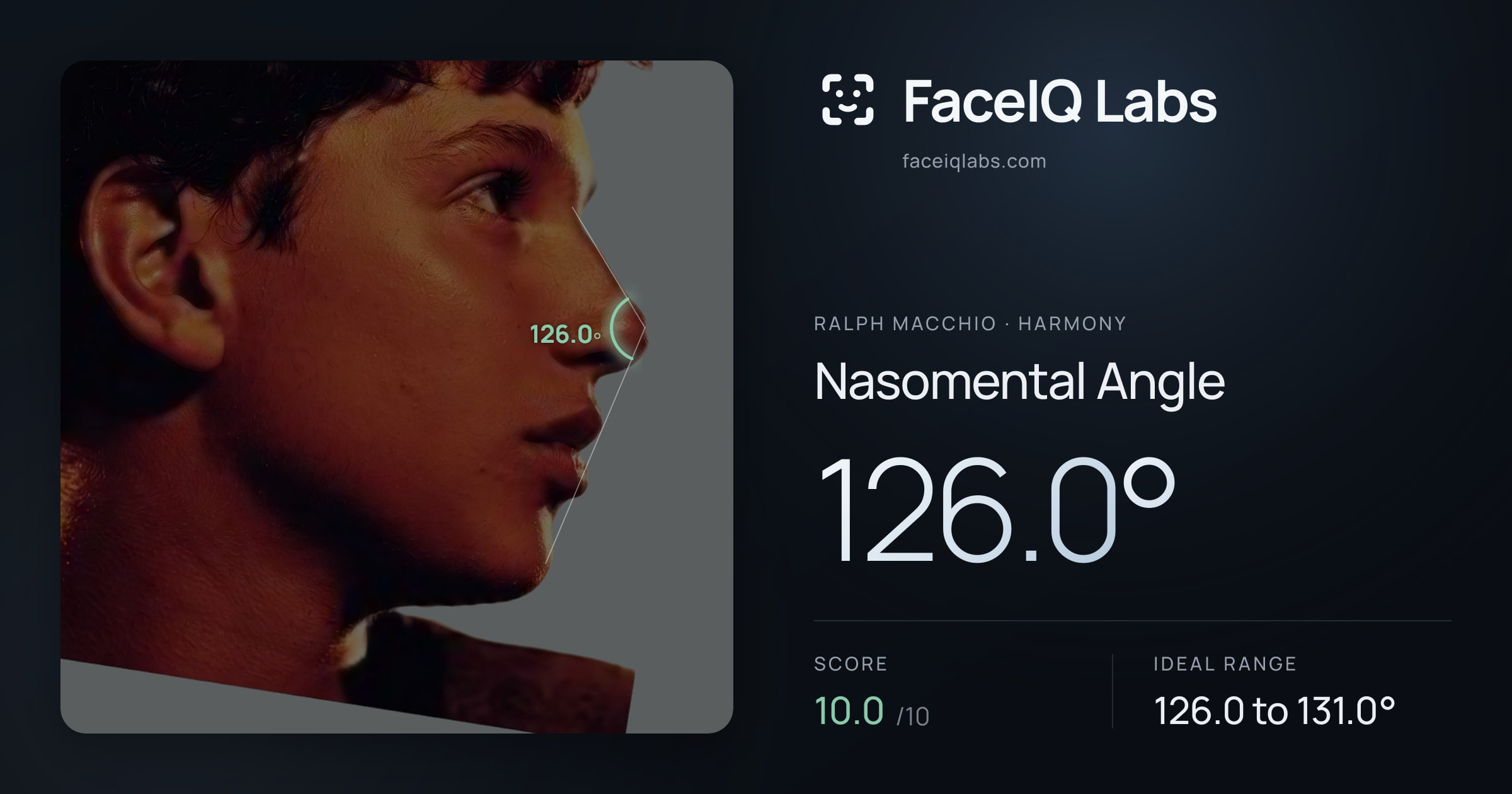 Ralph Macchio Nasomental Angle: 126.0°, drawn on the photo