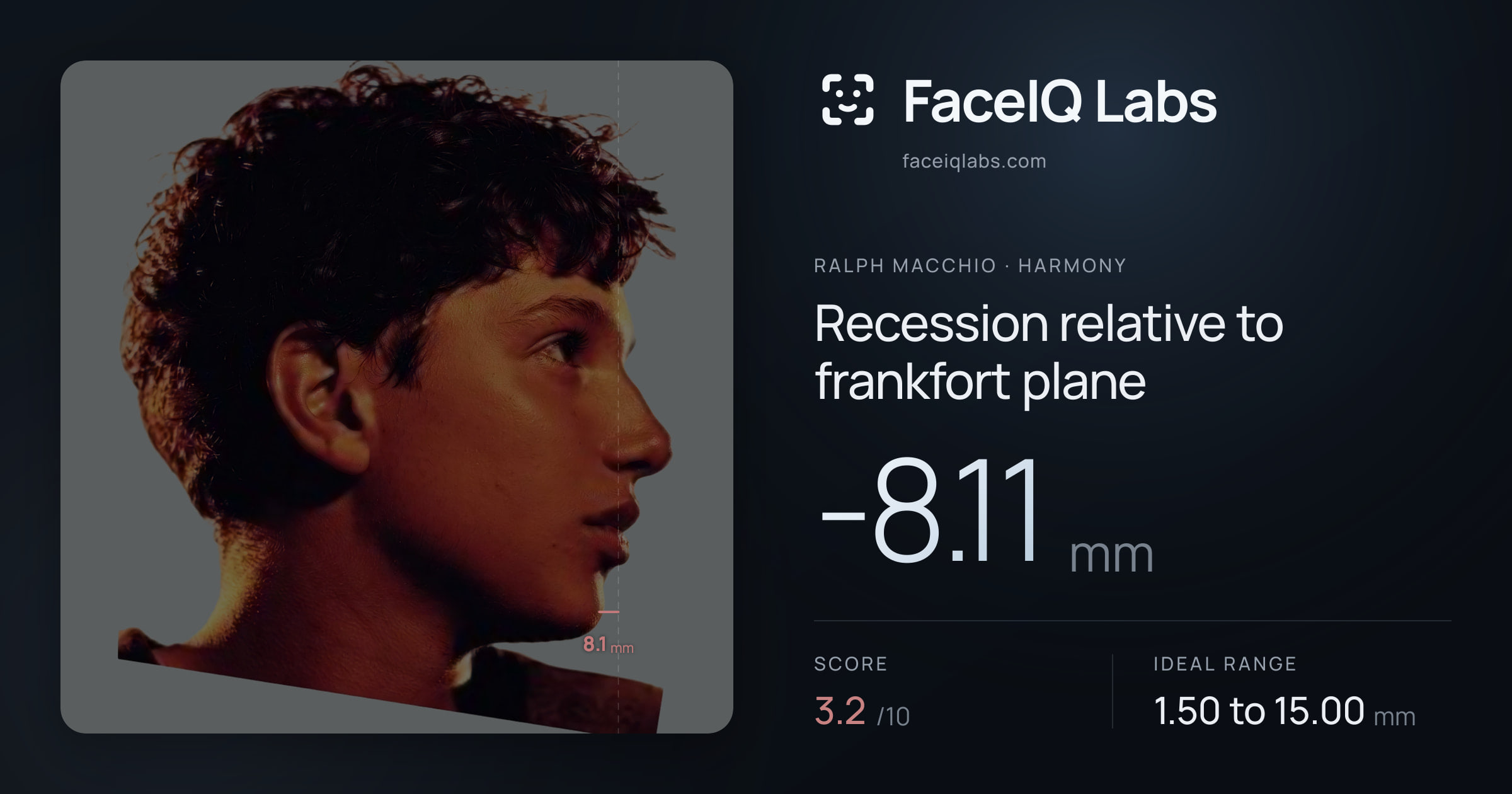 Ralph Macchio Recession relative to frankfort plane: -8.11mm, drawn on the photo