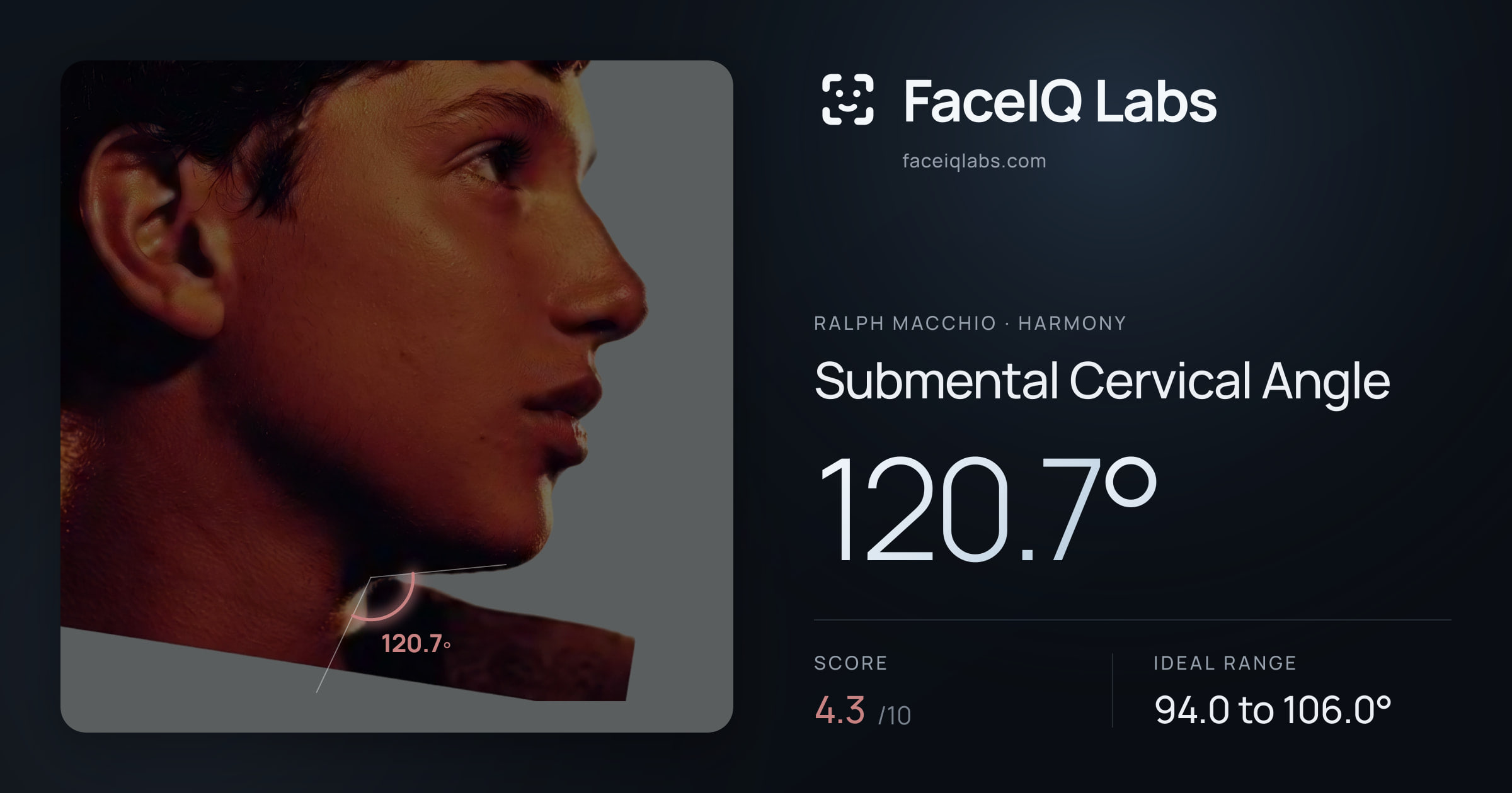 Ralph Macchio Submental Cervical Angle: 120.7°, drawn on the photo