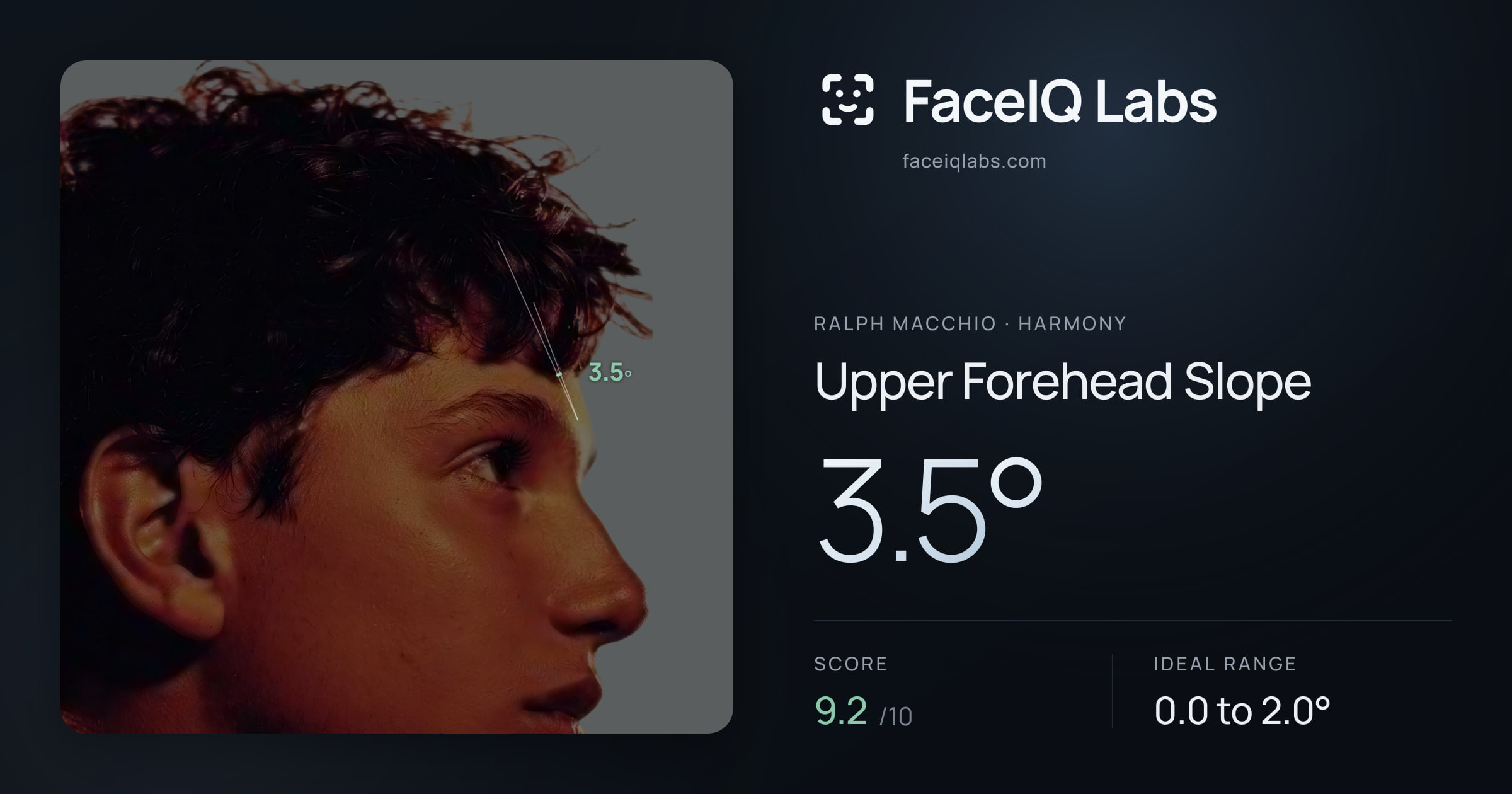 Ralph Macchio Upper Forehead Slope: 3.5°, drawn on the photo