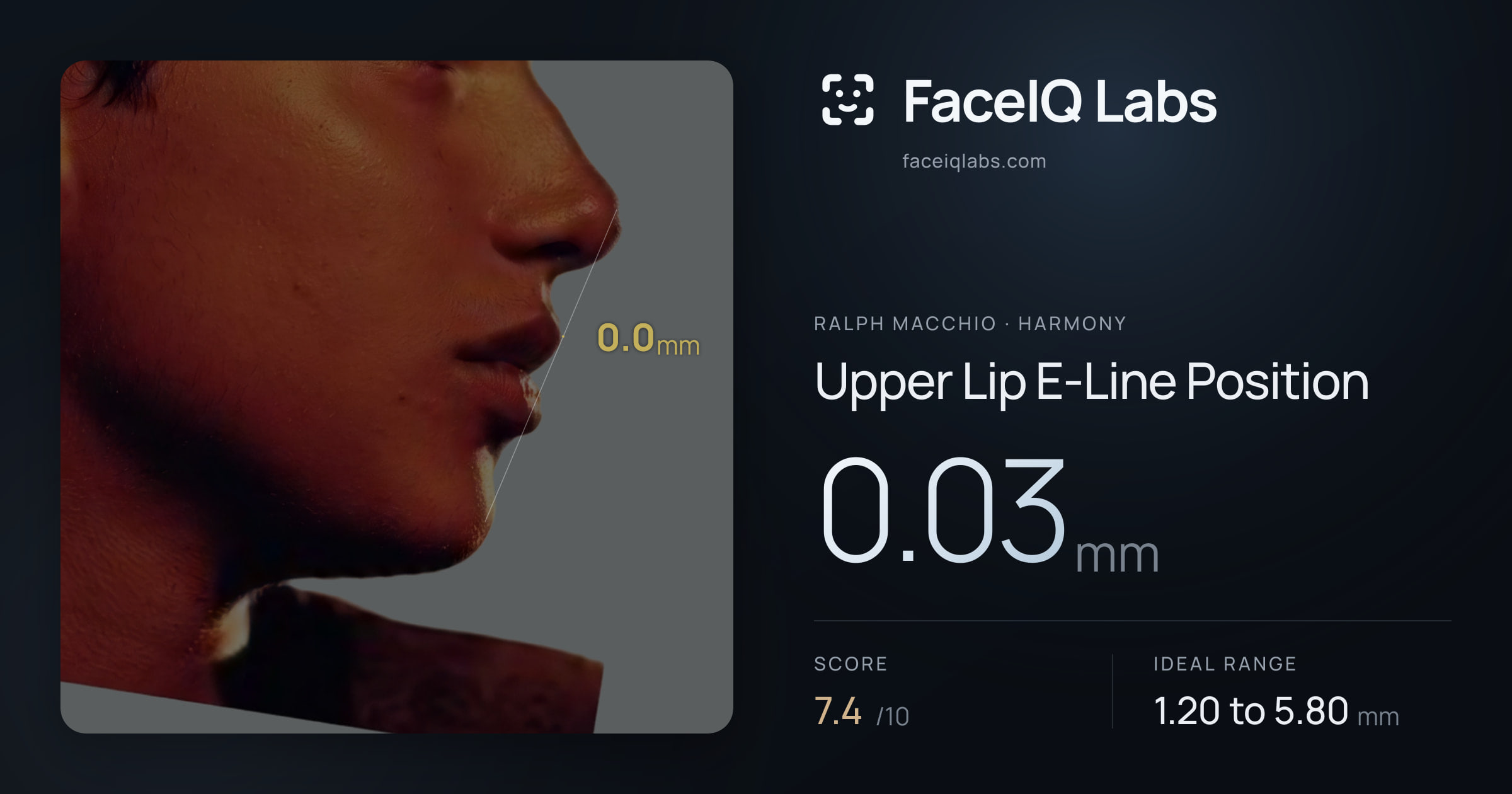 Ralph Macchio Upper Lip E-Line Position: 0.03mm, drawn on the photo