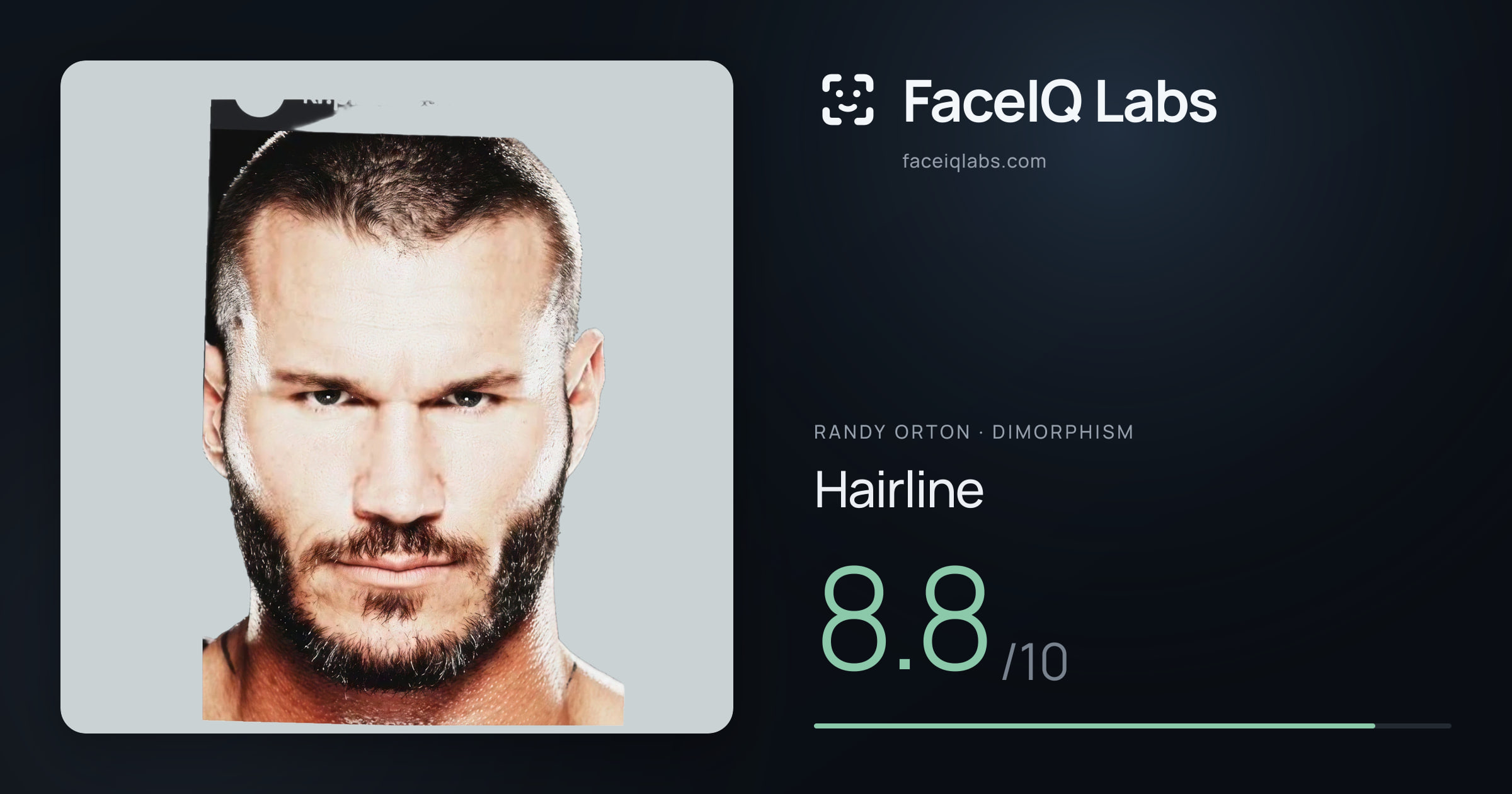 Randy Orton Hairline: 8.8/10, drawn on the photo