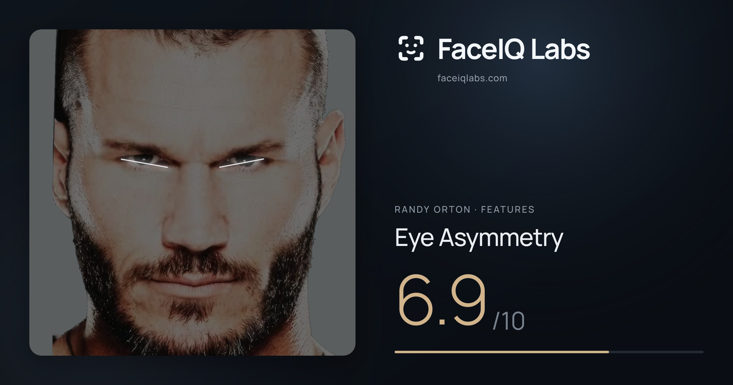 Randy Orton Eye Asymmetry: 6.9/10, drawn on the photo