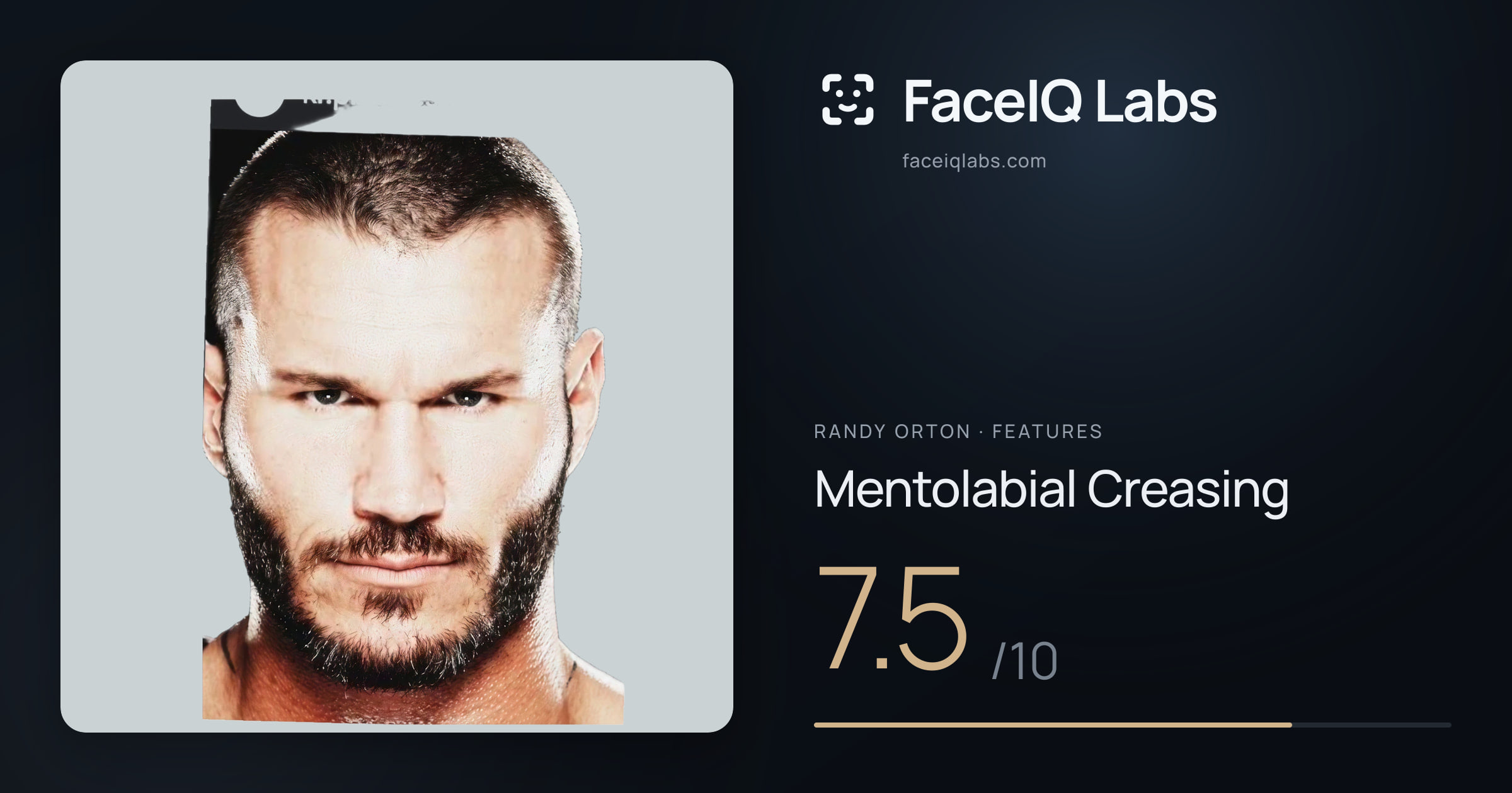 Randy Orton Mentolabial Creasing: 7.5/10, drawn on the photo